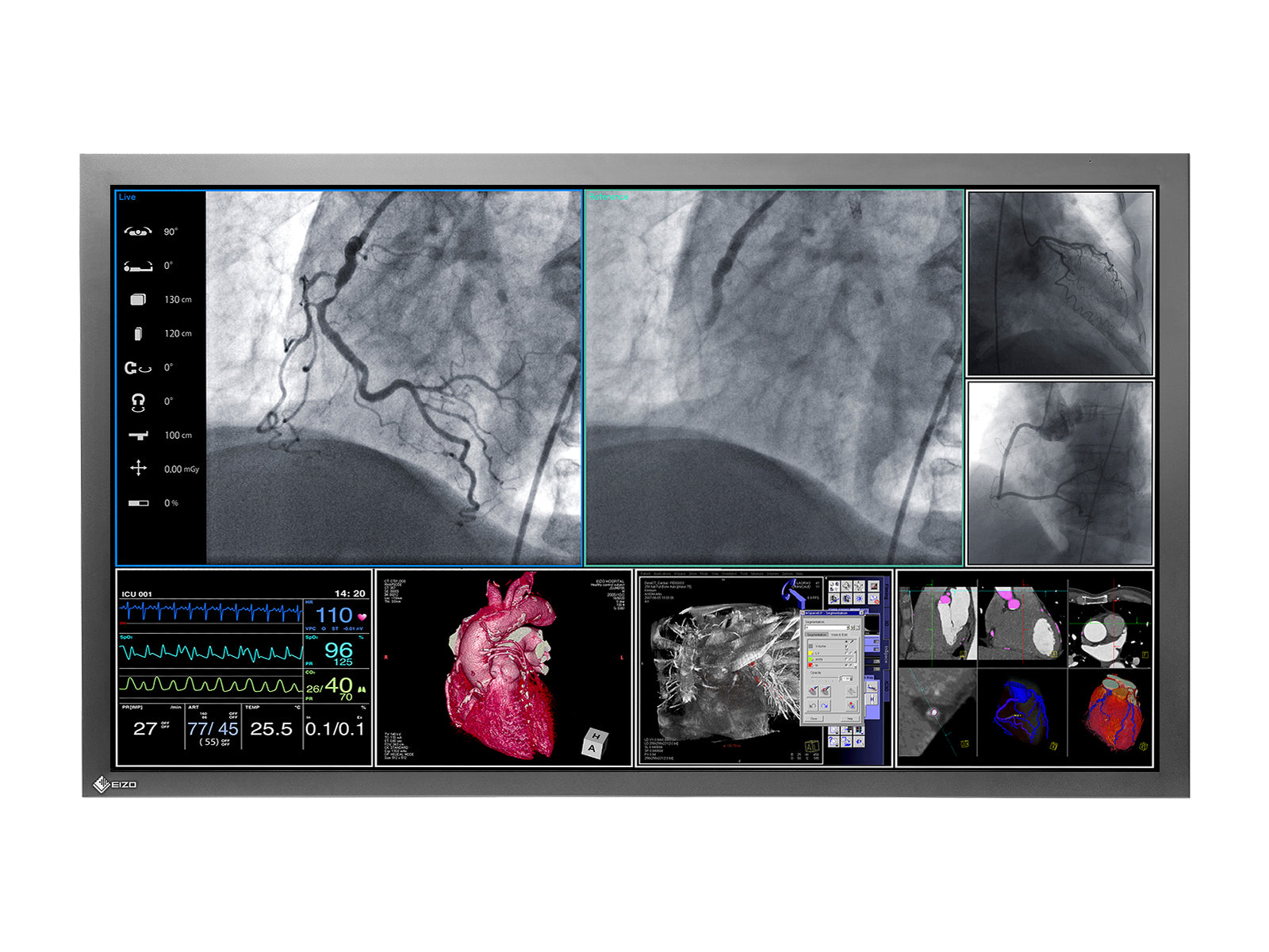 Eizo RadiForce LS560W Monitor de pantalla médica quirúrgica en color de 56" 8MP 4K (LS560W)