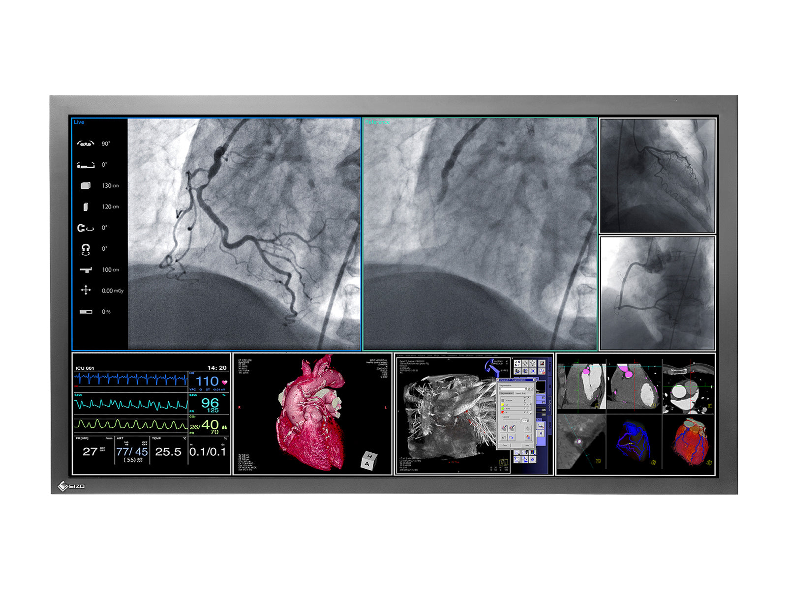 Eizo RadiForce LS560W 56" 8MP 4K Color Surgical Medical Display Monitor (LS560W)