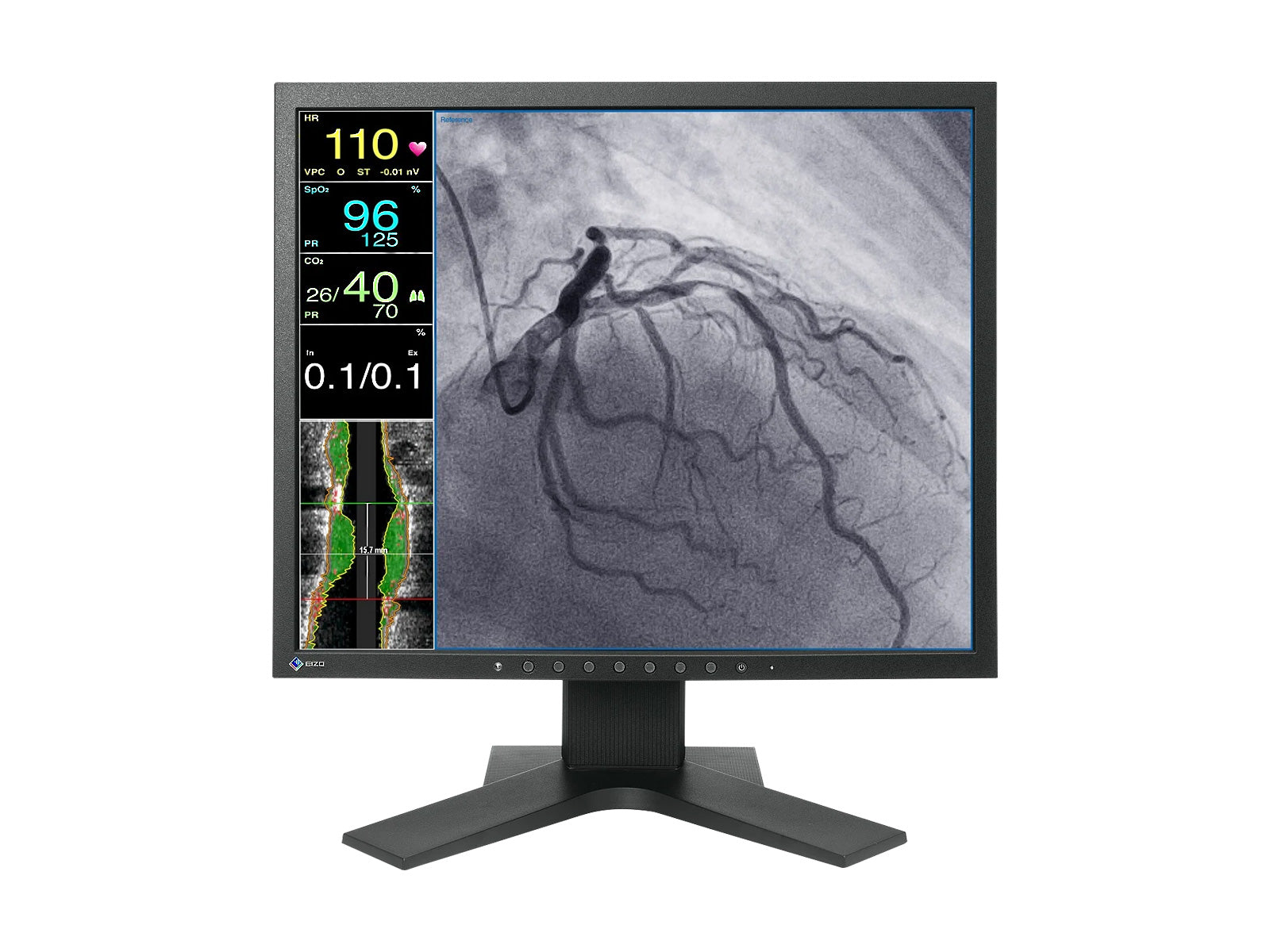 Eizo CuratOR 19" SXGA Moniteur LCD médical pour endoscopie chirurgicale (LX1910-S)