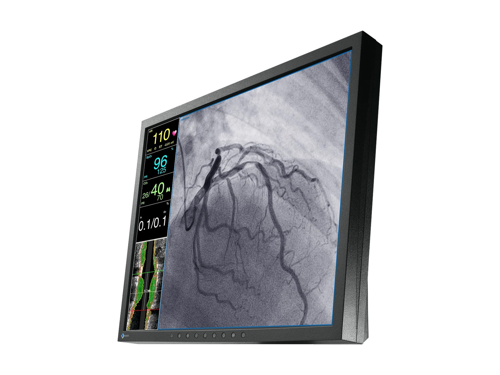 Eizo CuratOR 19" SXGA Moniteur LCD médical pour endoscopie chirurgicale (LX1910-S)