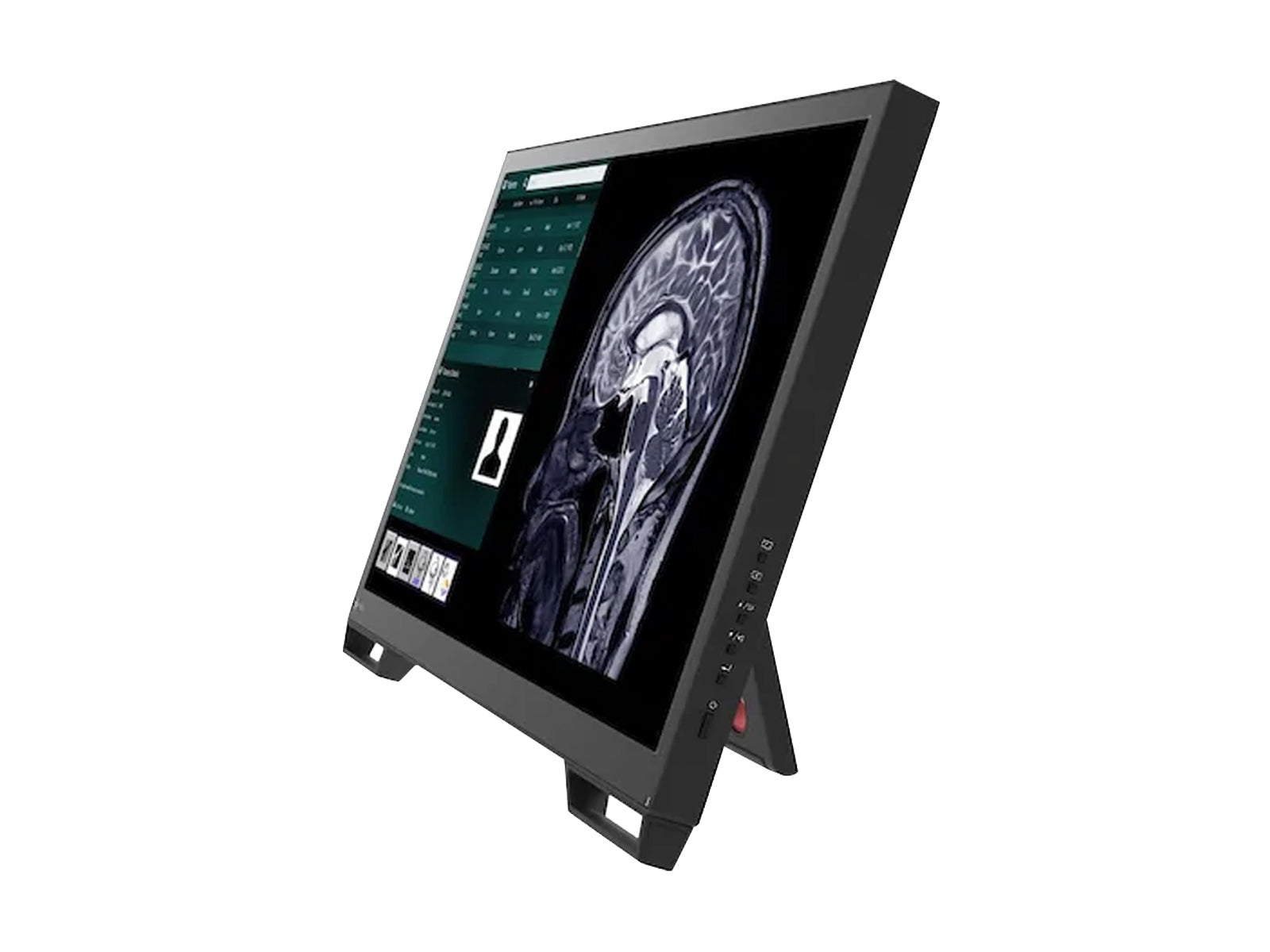 Eizo Écran tactile médical pour endoscopie chirurgicale de 23,8″ (LX2420-T)