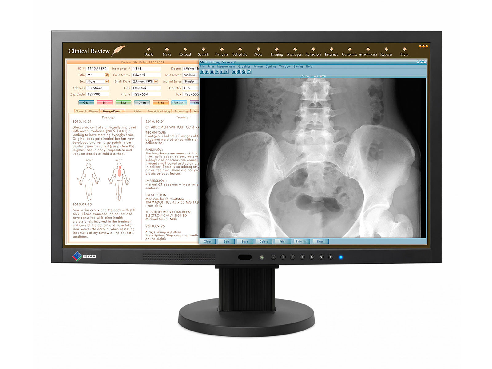 Eizo RadiForce MS230W 2MP Monitor Medico a Colori da 23" per Revisione Clinica (MS230WUKBKB)
