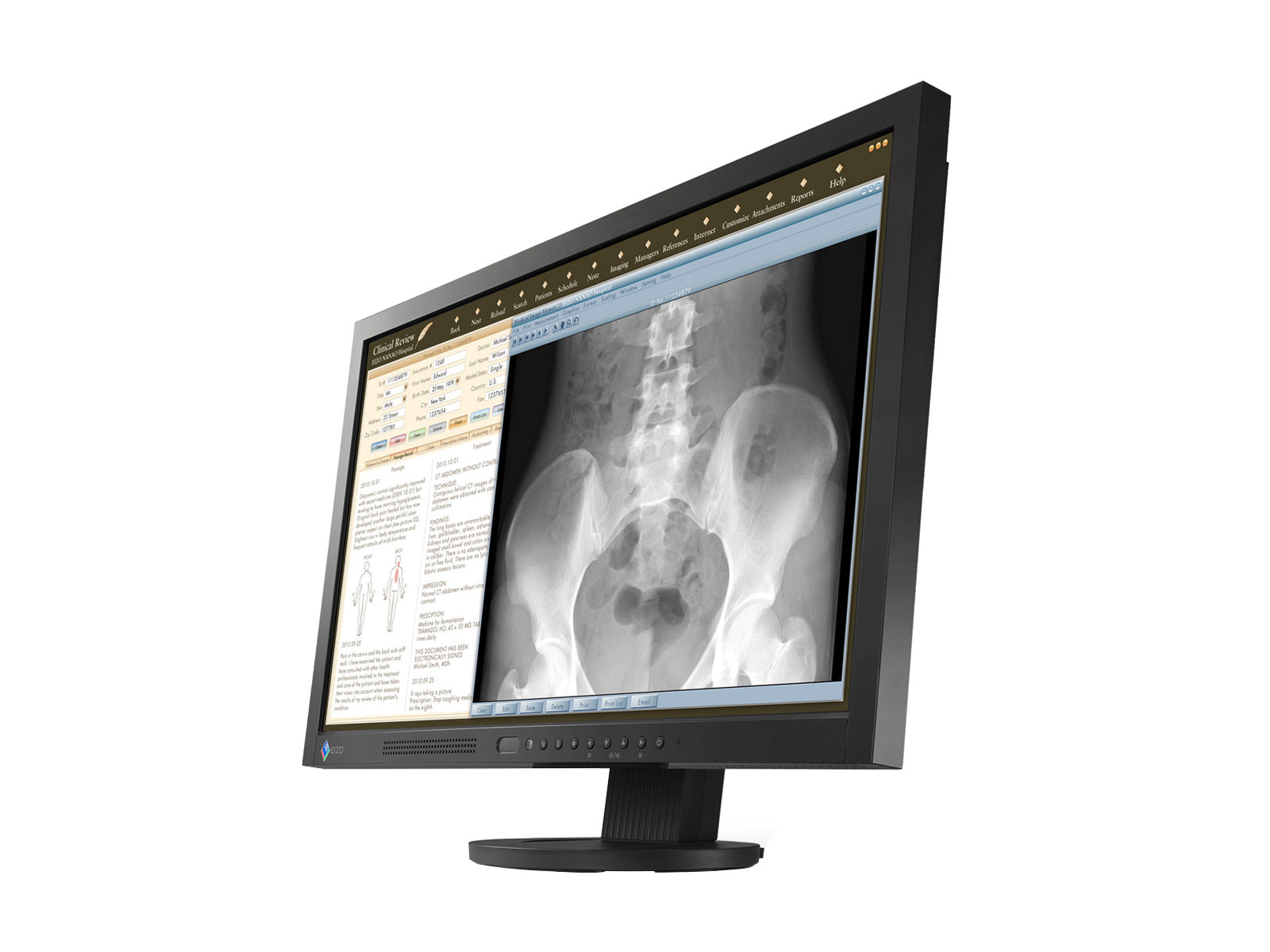 Eizo RadiForce MS230W 2MP Monitor Medico a Colori da 23" per Revisione Clinica (MS230WUKBKB)