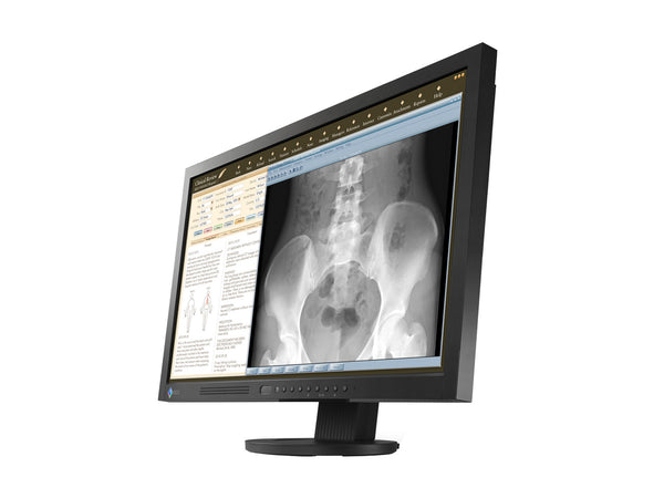Eizo RadiForce MS230W 2MP Monitor Medico a Colori da 23