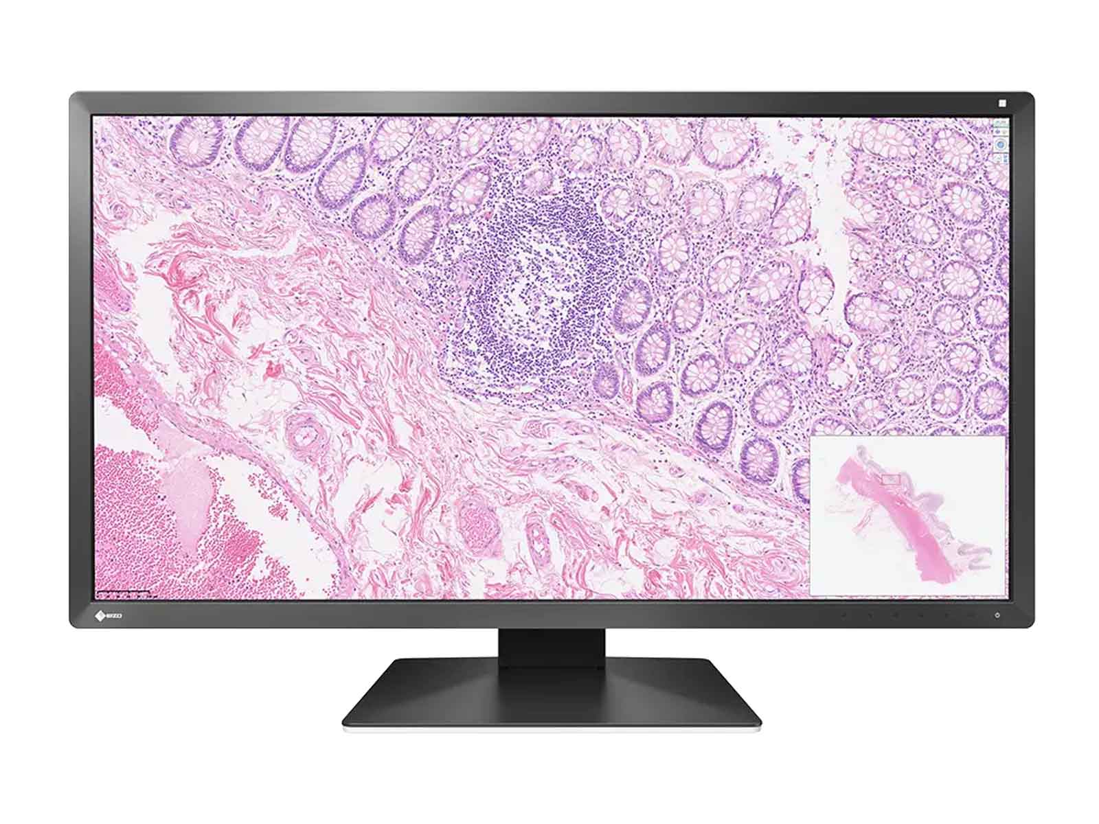 Eizo PX3150 