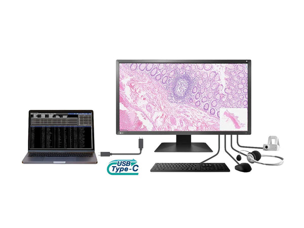 Eizo PX3150 