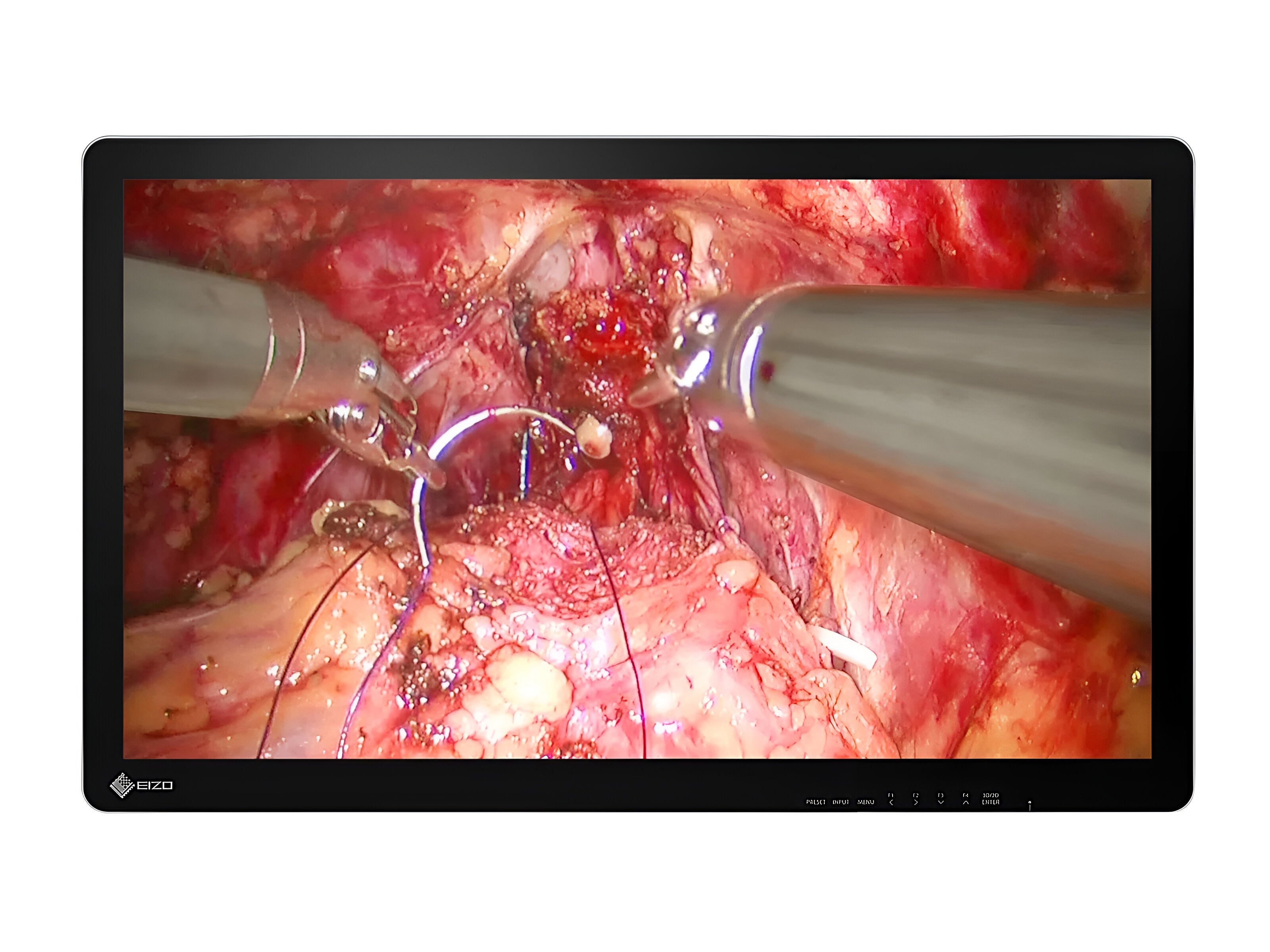 Eizo 32" 4K 3D IPS Surgical Medical Display Monitor (EX3242-3D)