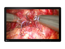 Eizo 32" 4K 3D IPS Surgical Medical Display Monitor (EX3242-3D)