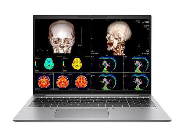 HP Zbook Firefly 16 G11 Estação de Trabalho Móvel de Radiologia | 16" WUXGA Calibrada DICOM | Intel Core Ultra 7 165H @ 5.0GHz | 16 núcleos | 32GB DDR5 | SSD NVMe de 512TB | Intel Arc Graphics 4GB | WiFi 6E