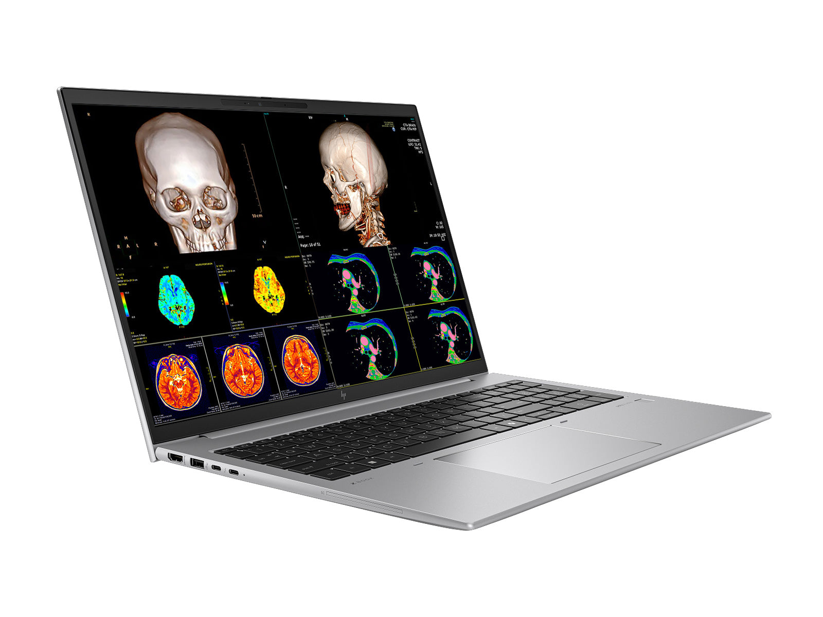 HP Zbook Firefly 16 G11 Estação de Trabalho Móvel de Radiologia | 16" WUXGA Calibrada DICOM | Intel Core Ultra 7 165H @ 5.0GHz | 16 núcleos | 32GB DDR5 | SSD NVMe de 512TB | Intel Arc Graphics 4GB | WiFi 6E