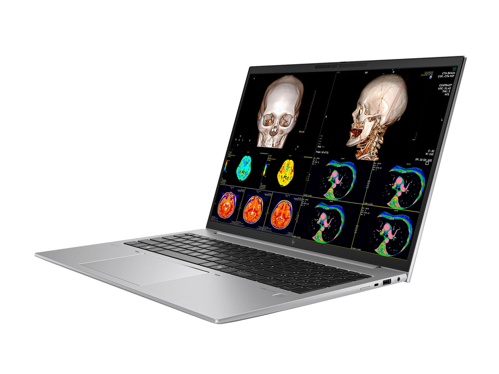 HP Zbook Firefly 16 G11 Estação de Trabalho Móvel de Radiologia | 16" WUXGA Calibrada DICOM | Intel Core Ultra 7 165H @ 5.0GHz | 16 núcleos | 32GB DDR5 | SSD NVMe de 512TB | Intel Arc Graphics 4GB | WiFi 6E