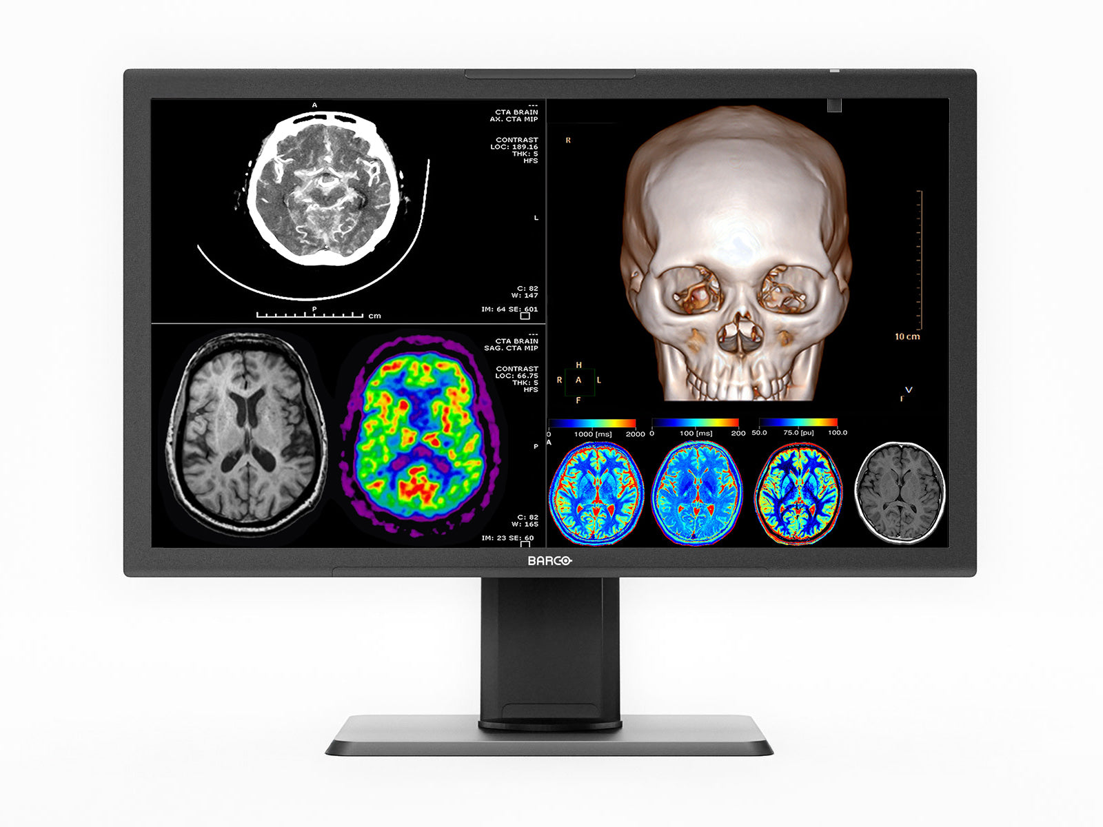Barco 27" 4K 8MP MDPC‑8127 Diagnostischer Radiologie-Medienmonitor (K9610269) 