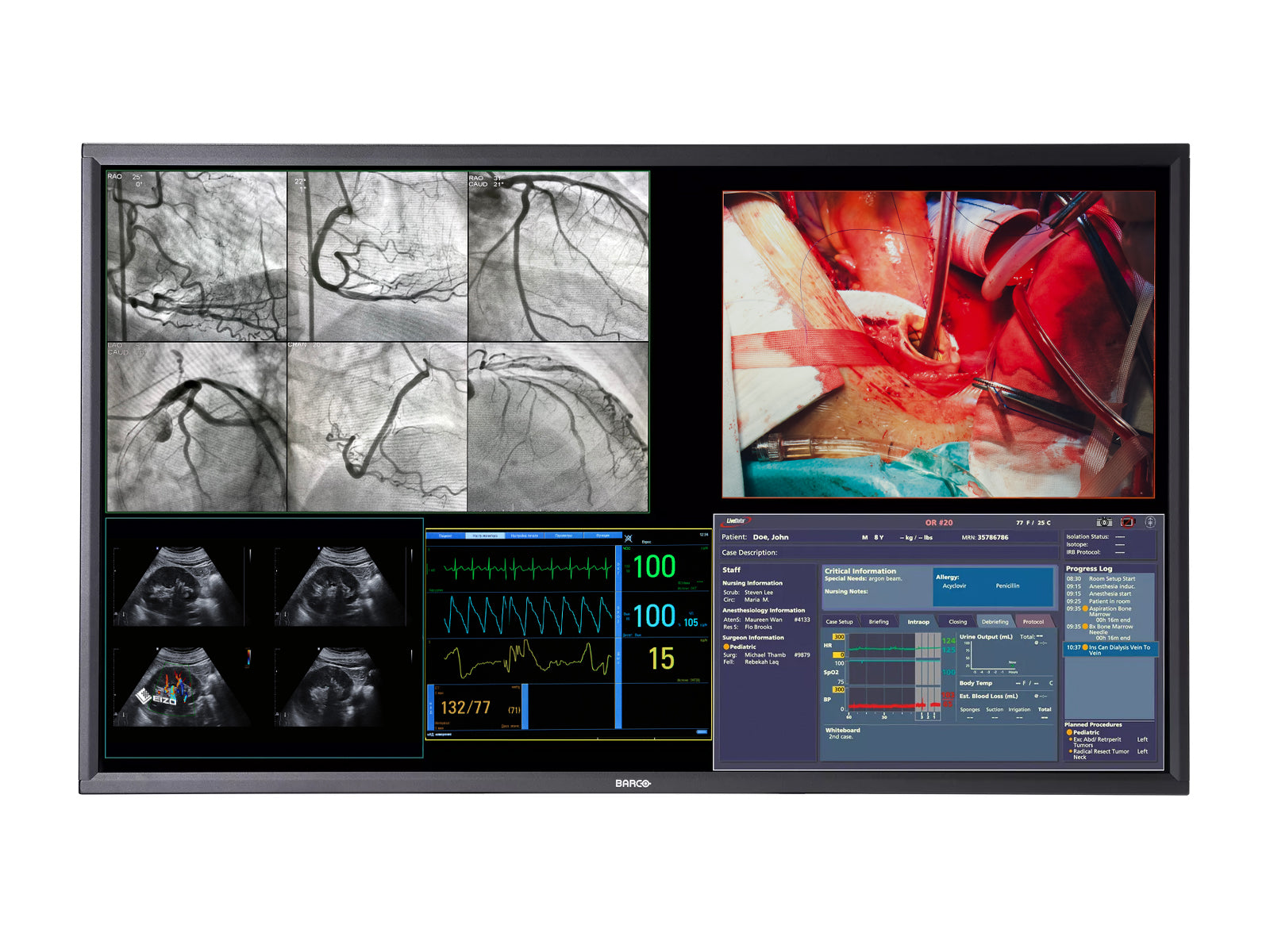 Barco MDSC-8358 58" 8MP 4K Color Surgical Medical Display Monitor (K9307938)