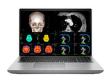HP ZBook Fury 16 G11 Stazione di lavoro radiologica mobile | OLED da 16 pollici 9MP Calibrato DICOM 4K+ UHD | Core i9-14900HX @ 5,8 GHz | 24-Core | DDR5 da 128 GB | SSD NVMe da 512 GB | RTX2000Ada8GB| WiFi 6E