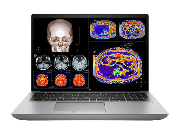 (Template)HP ZBook Fury 16 G11 Mobile Radiology Workstation | 16" 9MP 4K+ UHD DICOM Calibrated | Core i7-14700HX @ 5.5GHz | 20-Core | 32GB DDR5 | 1TB NVMe SSD | RTX 1000 Ada 6GB | WiFi 7 | Win11 Pro