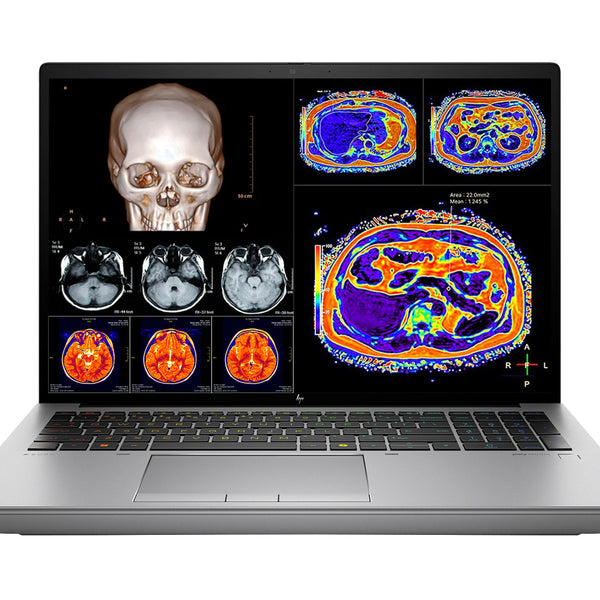 HP ZBook Fury 16 G11 Mobile Radiology Workstation | 16