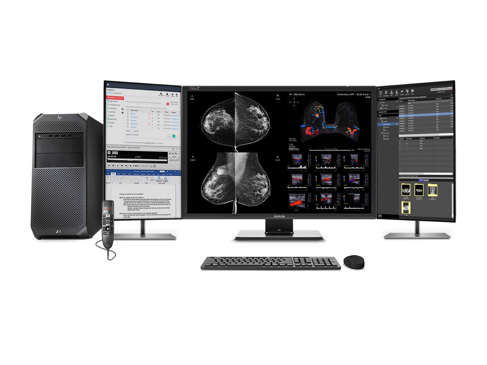 Complete Mammography Reading Station | Barco 12MP MDNC-12130 Color LED Monitors | Lenovo Workstation | Dictation Microphone (LFH3510)| Worklist Monitors (12130Z4G4R)