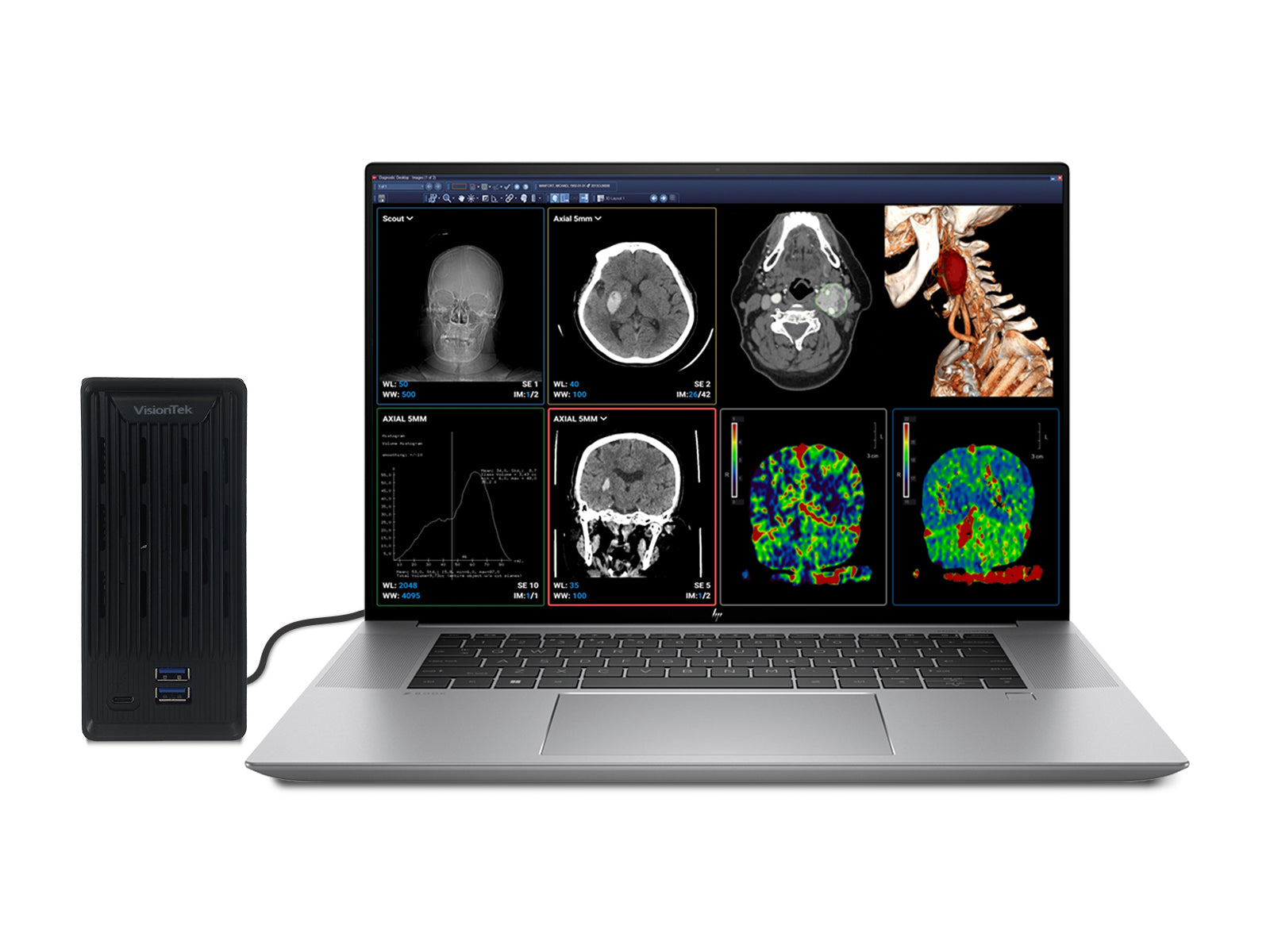 HP ZBook Studio 16 G9 Mobile Radiology Workstation | 16" 8MP UHD DICOM Calibrated | Core i7-12700H @ 4.70GHz | 64GB DDR5 | 1TB NVMe SSD | Barco eGFX with MXRT-6700 8GB | Win11 Pro Monitors.com 