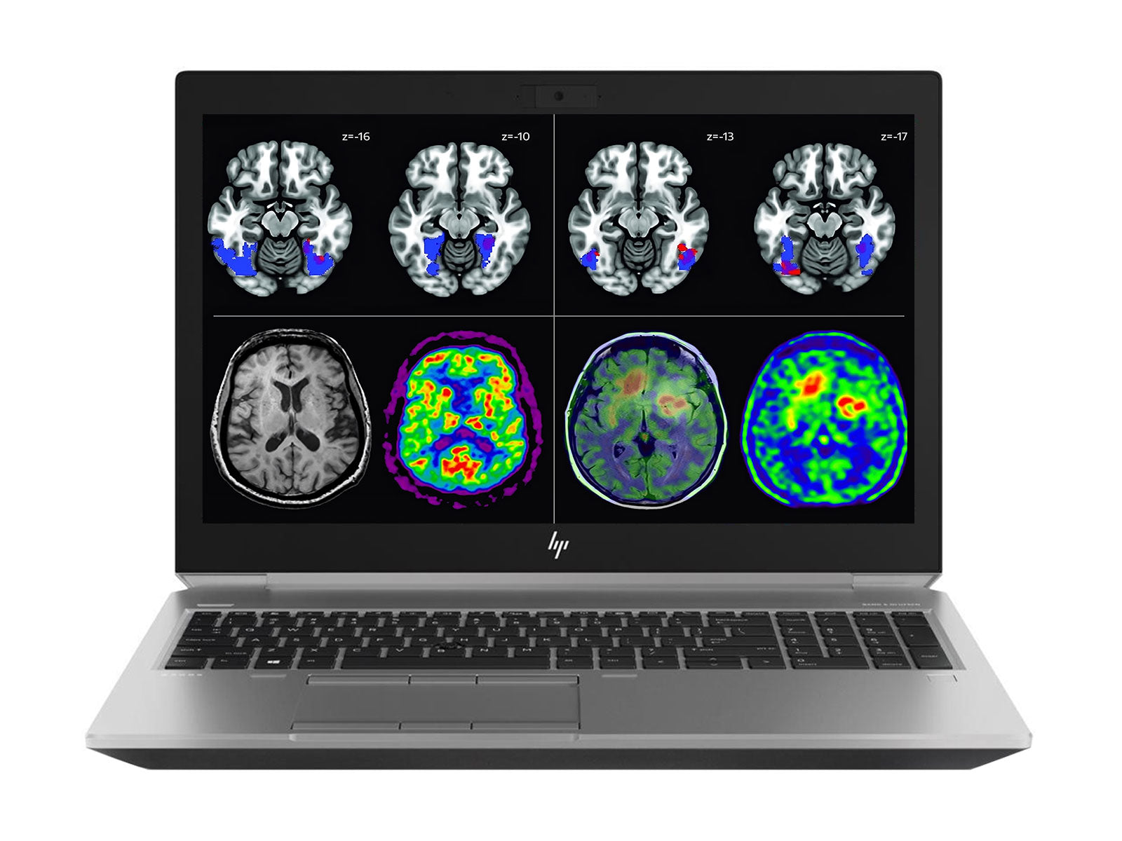 HP Zbook 17 G6 Mobile Radiology Workstation | 17.3 "FHD DICOM Calibrated | Core i7-9850H " 4.60GHz | 128GB DDR4 | 512GB NVMe | Nvidia RTX 5000 16GB