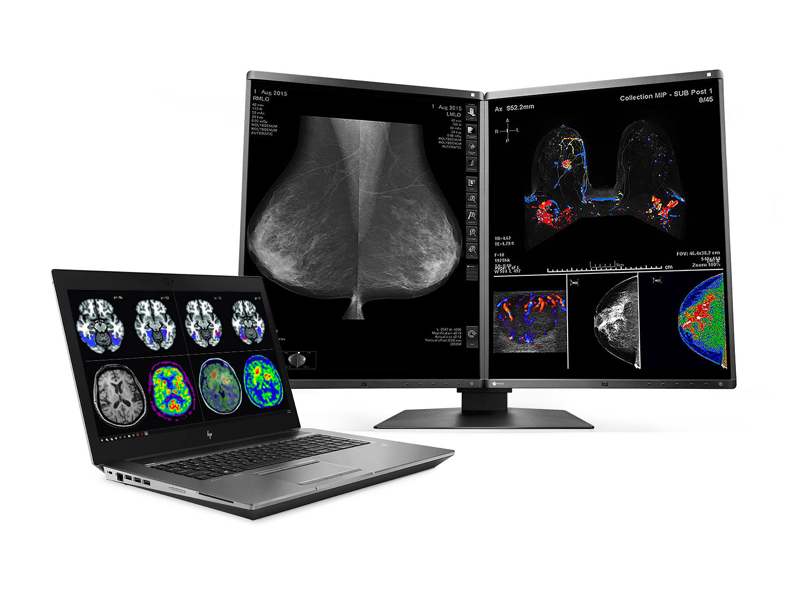 HP Zbook 17 G6 Mobile Radiology Workstation | 17.3" FHD DICOM Calibrated | Core i7-9850H @ 4.60GHz | 128GB DDR4 | 512GB NVMe | Nvidia RTX 5000 16GB | Win10 Pro Monitors.com 