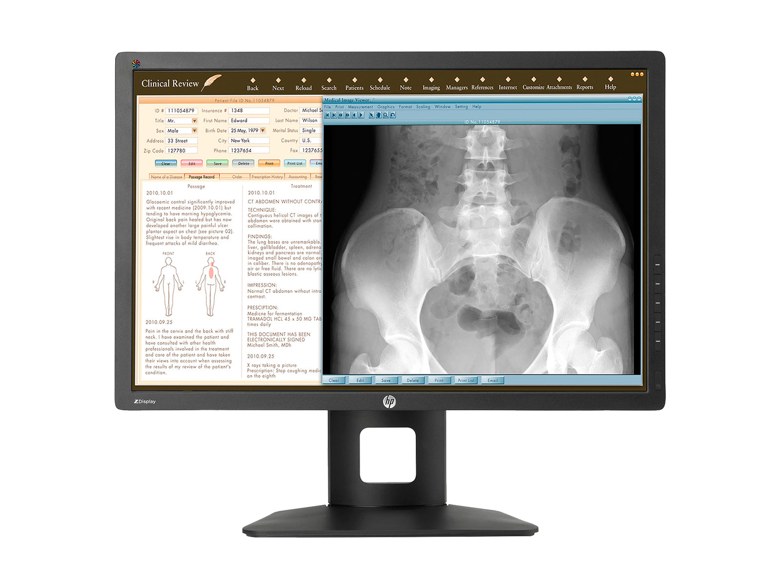 Komplette Mammographie-Lesestation | Barco 5MP Graustufen-LED-Monitor | Dell-Workstation | Diktiermikrofon | Arbeitslistenmonitor (5221Z24X)