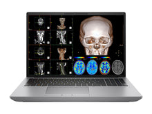 HP ZBook Fury 16 G10 Estação de trabalho de radiologia móvel | 16 "OLED 9MP 4K+ UHD DICOM calibrado | Core i9-13950HX @ 5.50GHz | De 24 núcleos | 64GB DDR5 | 1TB NVMe SSD | RTX 5000 Ada 16GB | WiFi 6E