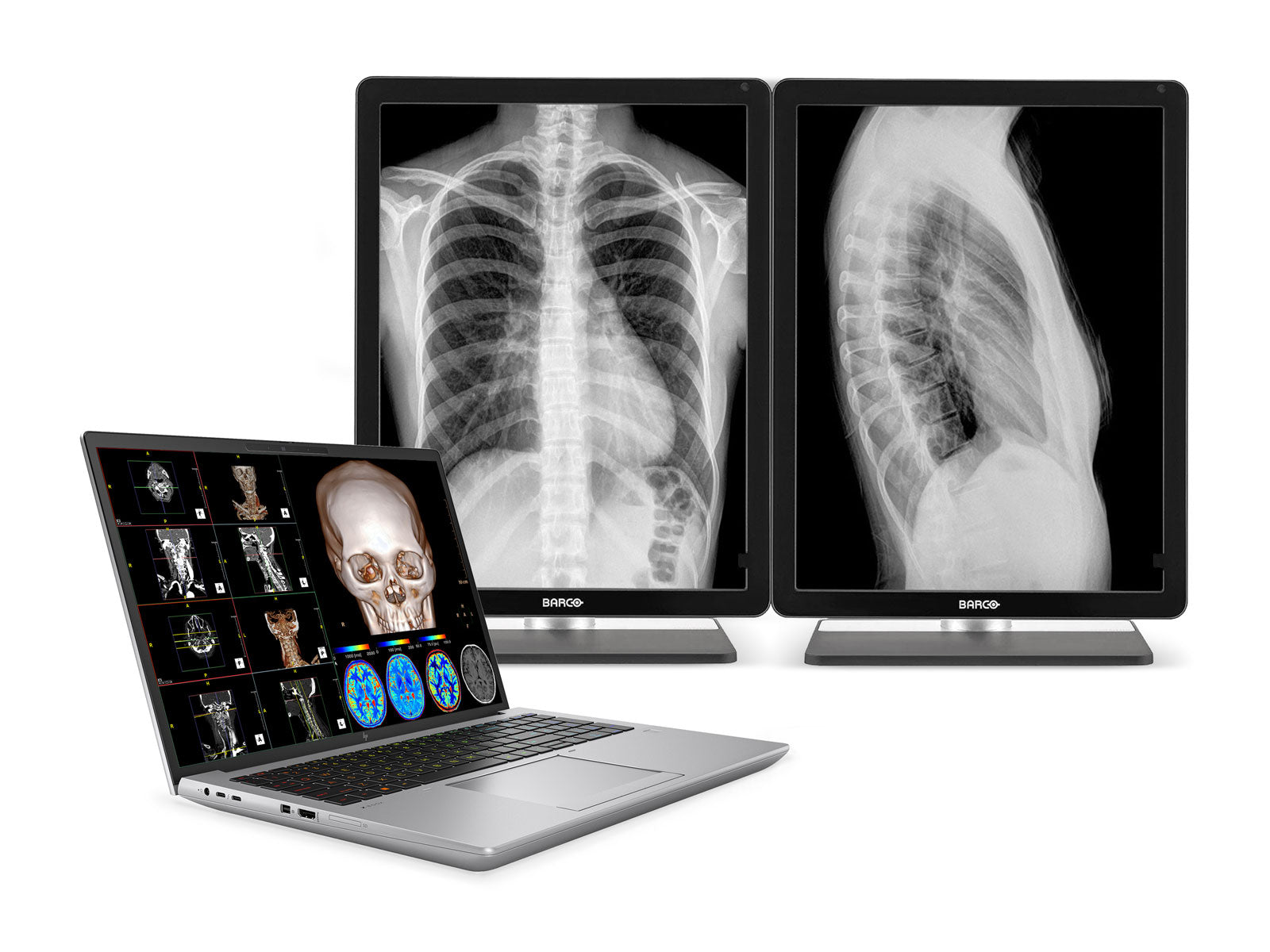 HP ZBook Fury 16 G10 Mobile Radiology Workstation | 16" 9MP 4K+ UHD DICOM Calibrated | Core i7-13850HX @ 5.30GHz | 20-Core | 32GB DDR5 | 1TB NVMe SSD | RTX 3500 Ada 12GB | WiFi 6E