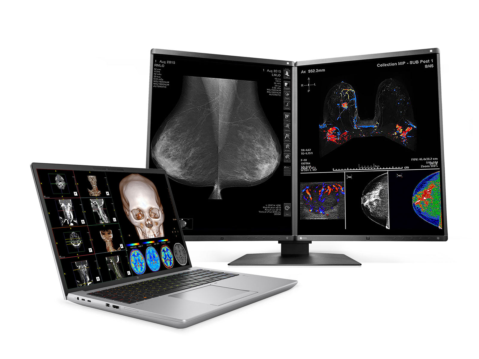 HP ZBook Fury 16 G10 Mobile Radiology Workstation | 16" OLED 9MP 4K+ UHD DICOM Calibrated | Core i9-13950HX @ 5.50GHz | 24-Core | 128GB DDR5 | 1TB NVMe SSD | RTX 5000 Ada 16GB | WiFi 6E
