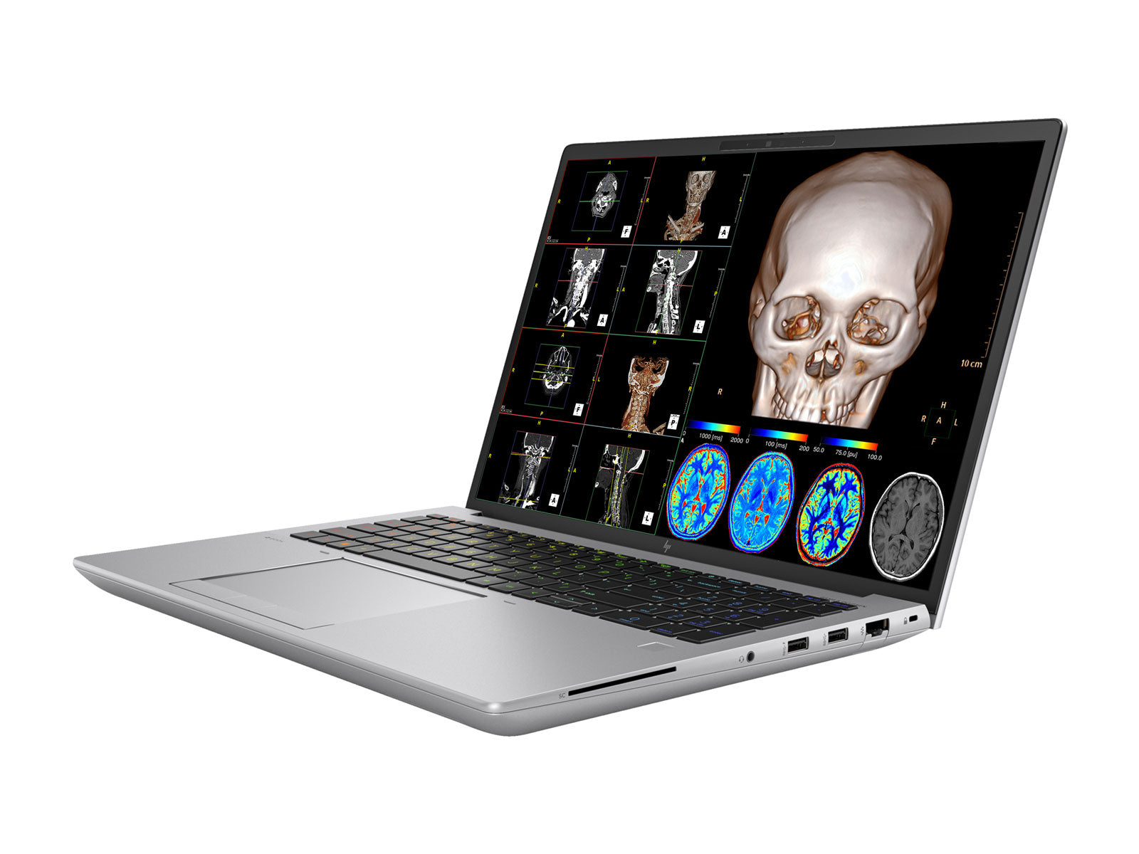HP ZBook Fury 16 G10 Mobile Radiology Workstation | 16" OLED 9MP 4K+ UHD DICOM Calibrated | Core i9-13950HX @ 5.50GHz | 24-Core | 128GB DDR5 | 1TB NVMe SSD | RTX 5000 Ada 16GB | WiFi 6E