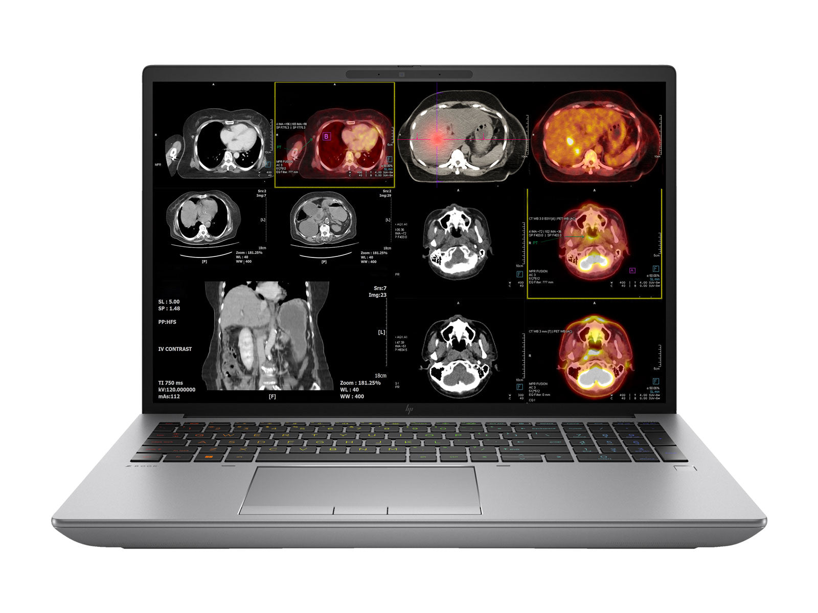 Station de travail de radiologie mobile HP ZBook Fury 16 G10 | 16" WQUXGA 8MP+ DICOM calibré | Core i9-13950HX à 5.5 GHz | 128 Go DDR5 | SSD NVMe 1 To | RTX A5500 16 Go | Win11 Pro
