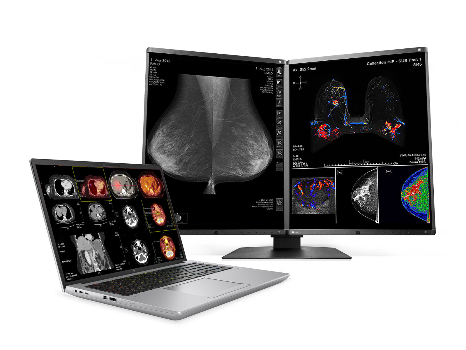 HP ZBook Fury 16 G10 Mobile Radiology Workstation | 16" WQUXGA 8MP+ DICOM Calibrated | Core i9-13950HX @ 5.5GHz | 128GB DDR5 | 1TB NVMe SSD | RTX A5500 16GB | Win11 Pro