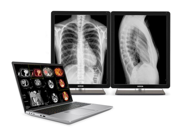 HP ZBook Fury 16 G10 Mobile Radiology Workstation | 16