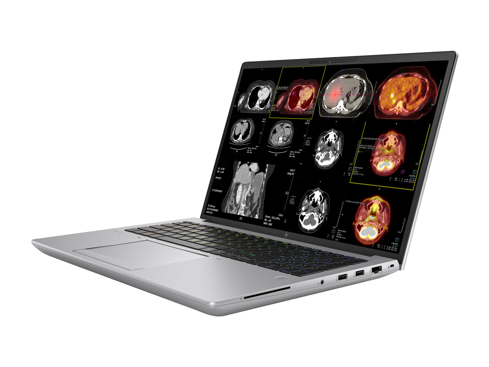 HP Zbook Fury 16 G10 Mobile Radiology Workstation | 16 " 8MP 4K UHD DICOM calibré | Core i9-13950HX @ 5,5 GHz | 128 Go DDR5 | 1 To NVME SSD | RTX 5000 ADA 16 Go | WiFi 6E