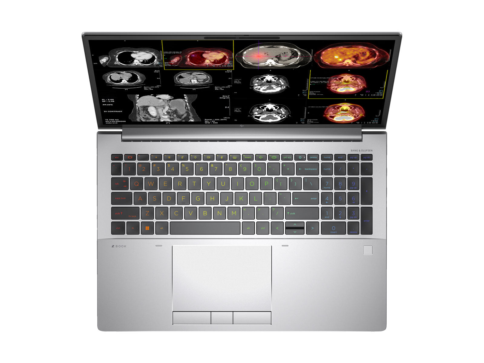 Estação de trabalho de radiologia móvel HP ZBook Fury 16 G10 | 16" 8MP 4K UHD DICOM Calibrado | Núcleo i9-13950HX @ 5.5GHz | 128 GB DDR5 | SSD NVMe de 2 TB | RTX 5000 Ada 16GB | Wi-Fi 6E | Win10-11 Profissional