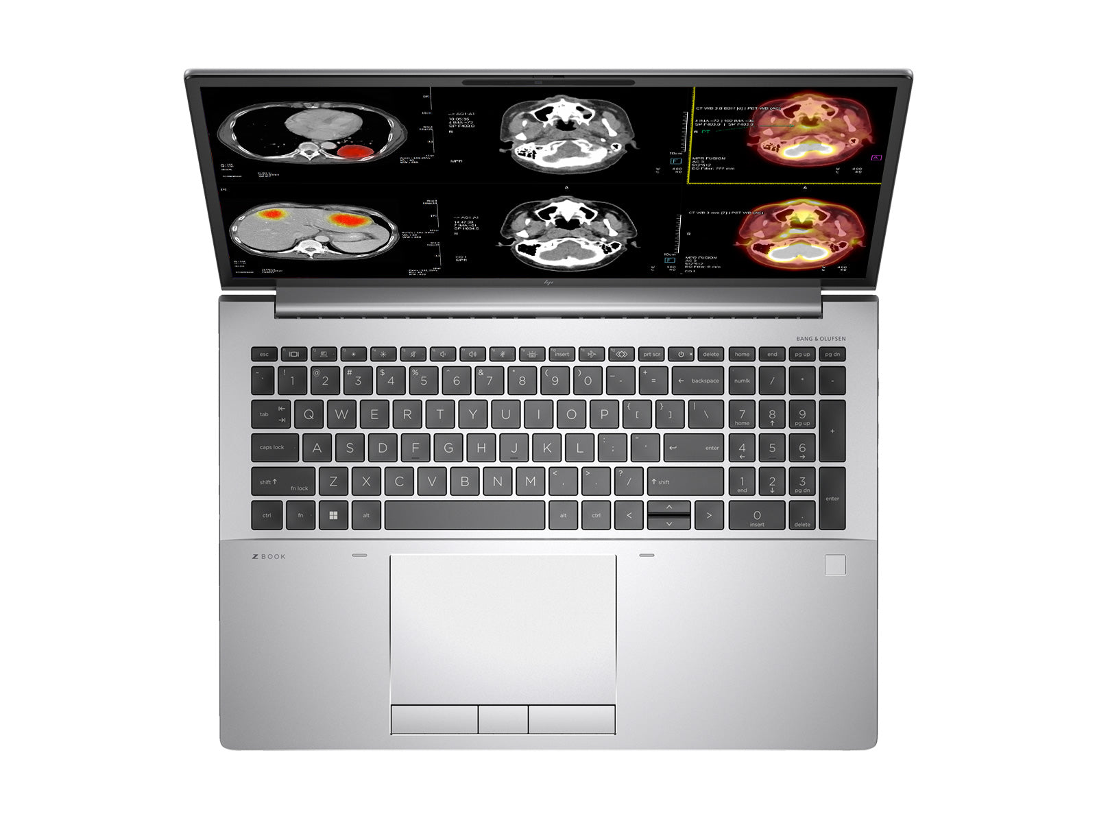 HP ZBook Fury 16 G9 Mobile Radiology Workstation | 16" WUXGA DICOM Calibrated | Core i9-12950HX @ 5.0GHz | 128GB DDR5 | 1TB NVMe SSD | NVIDIA RTX A4500 16GB | Win11 Pro Monitors.com 