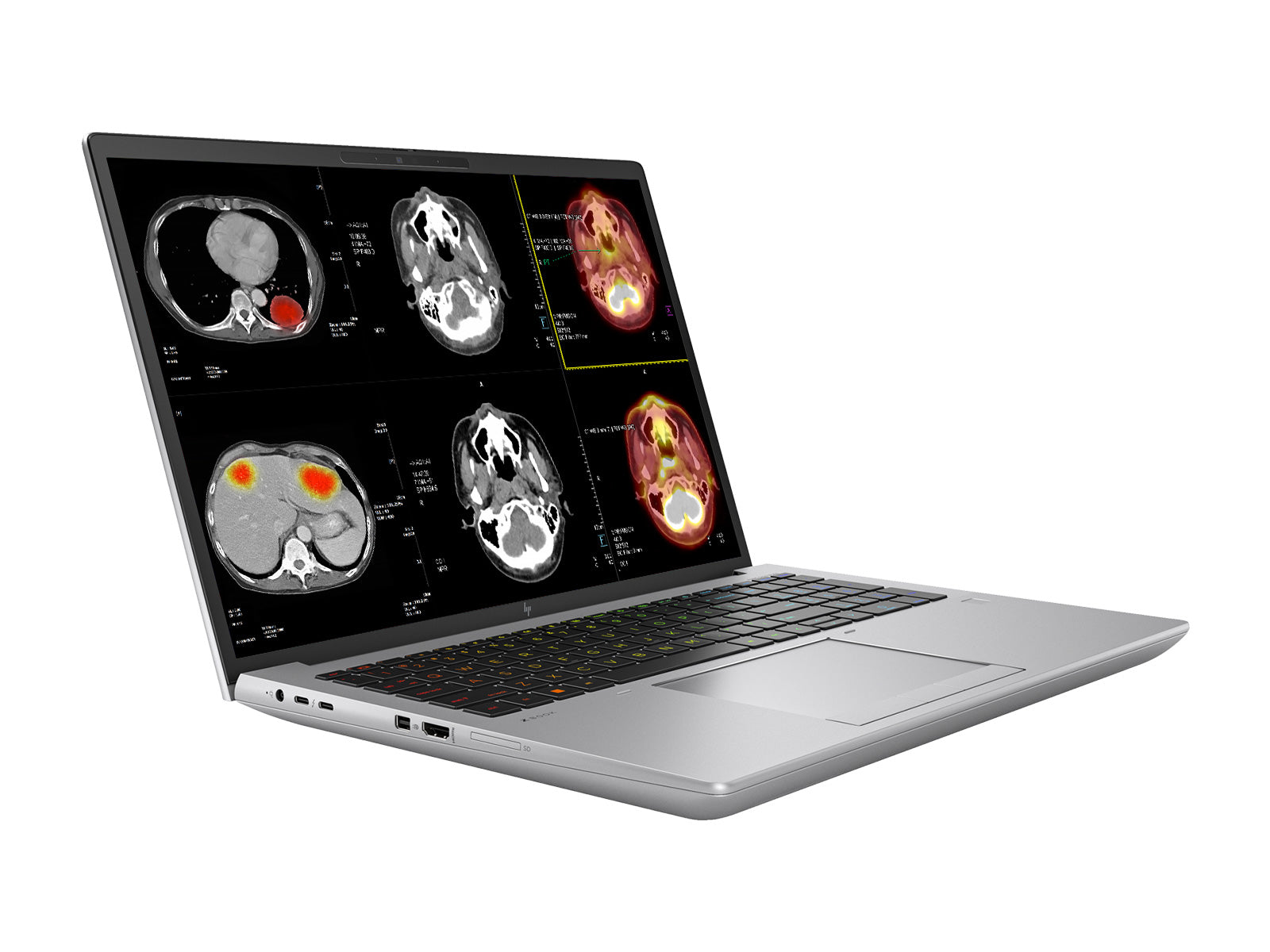 HP ZBook Fury 16 G9 Mobile Radiology Workstation | 16" WUXGA DICOM Calibrated | Core i9-12950HX @ 5.0GHz | 64GB DDR5 | 1TB NVMe SSD | NVIDIA RTX A5500 16GB | Win11 Pro Monitors.com 