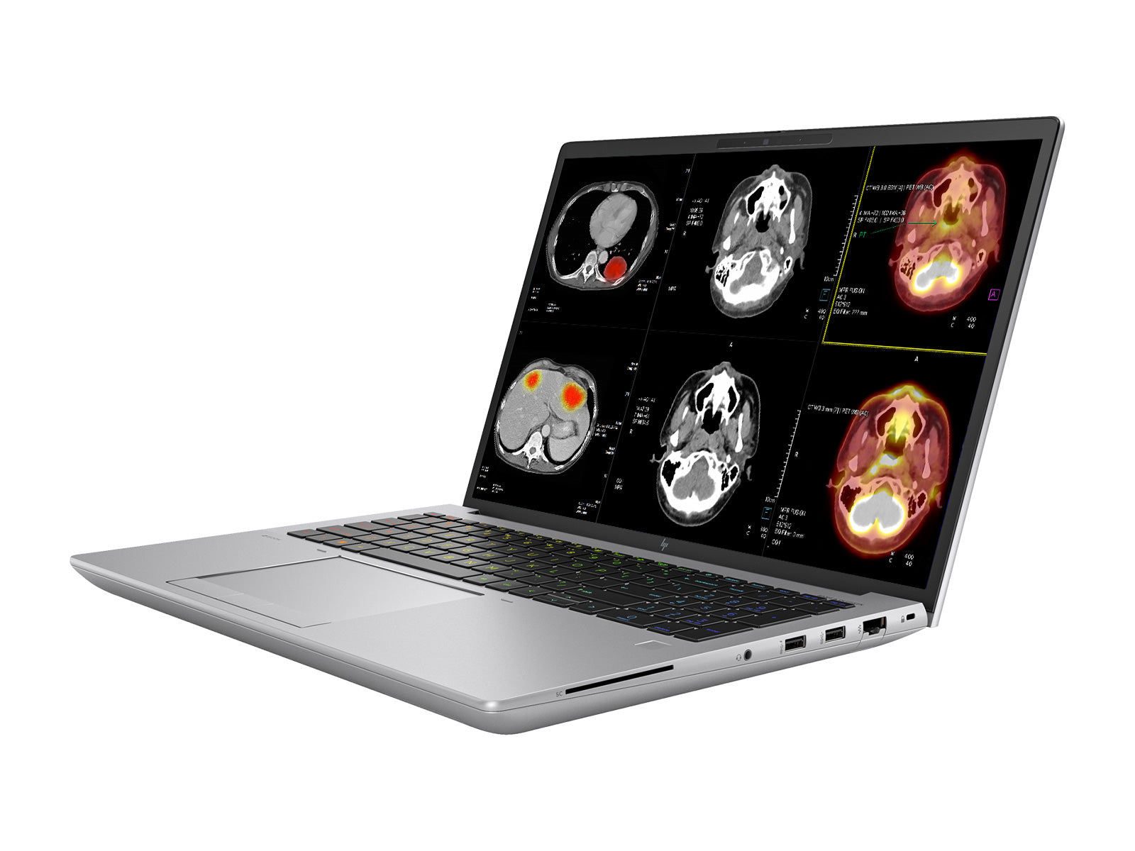 HP ZBook Fury 16 G9 Mobile Radiology Workstation | 16" WUXGA DICOM Calibrated | Core i9-12950HX @ 5.0GHz | 64GB DDR5 | 1TB NVMe SSD | NVIDIA RTX A5500 16GB | Win11 Pro Monitors.com 