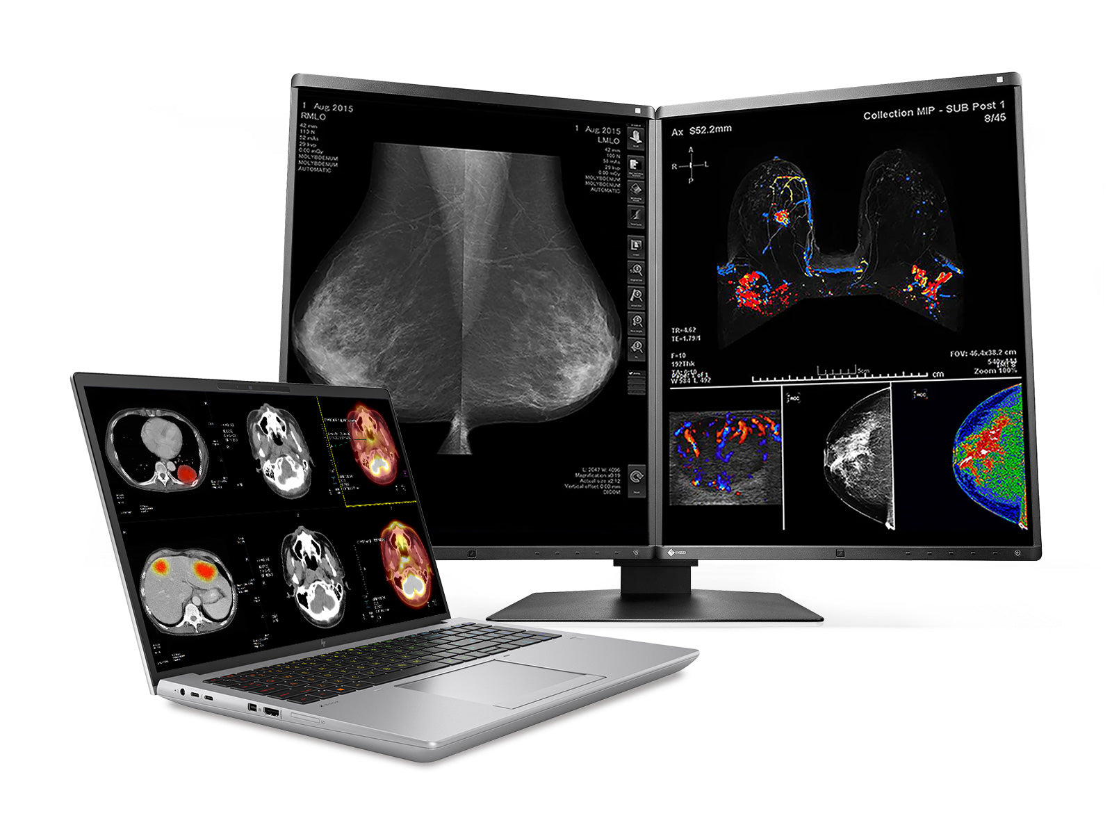 HP ZBook Fury 16 G9 Mobile Radiology Workstation | 16" WUXGA DICOM Calibrated | Core i9-12950HX @ 5.0GHz | 64GB DDR5 | 1TB NVMe SSD | NVIDIA RTX A5500 16GB | Win11 Pro Monitors.com 