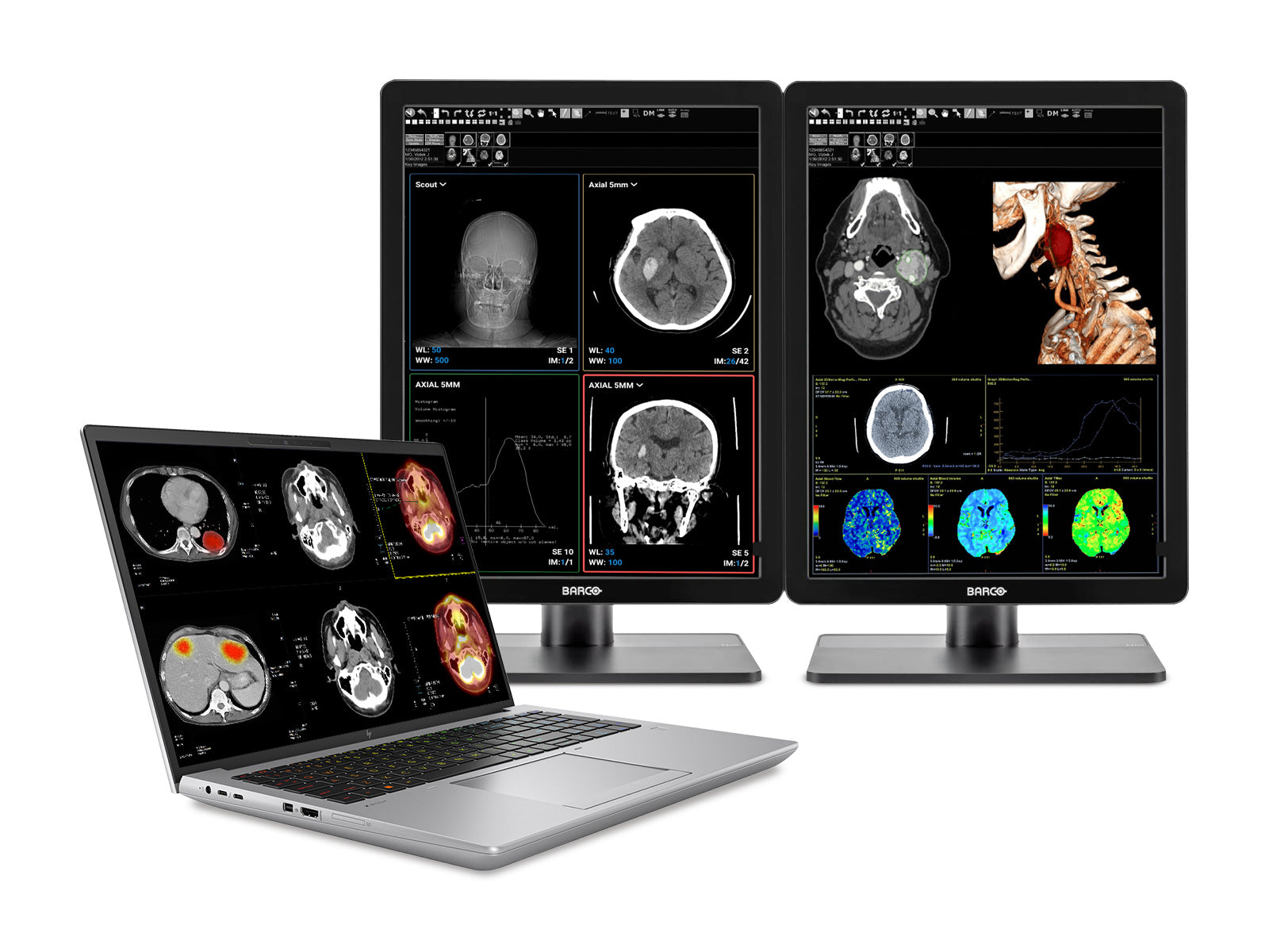 HP ZBook Fury 16 G9 Mobile Radiology Workstation | 16" WUXGA DICOM Calibrated | Core i9-12950HX @ 5.0GHz | 64GB DDR5 | 1TB NVMe SSD | NVIDIA RTX A5500 16GB | Win11 Pro Monitors.com 