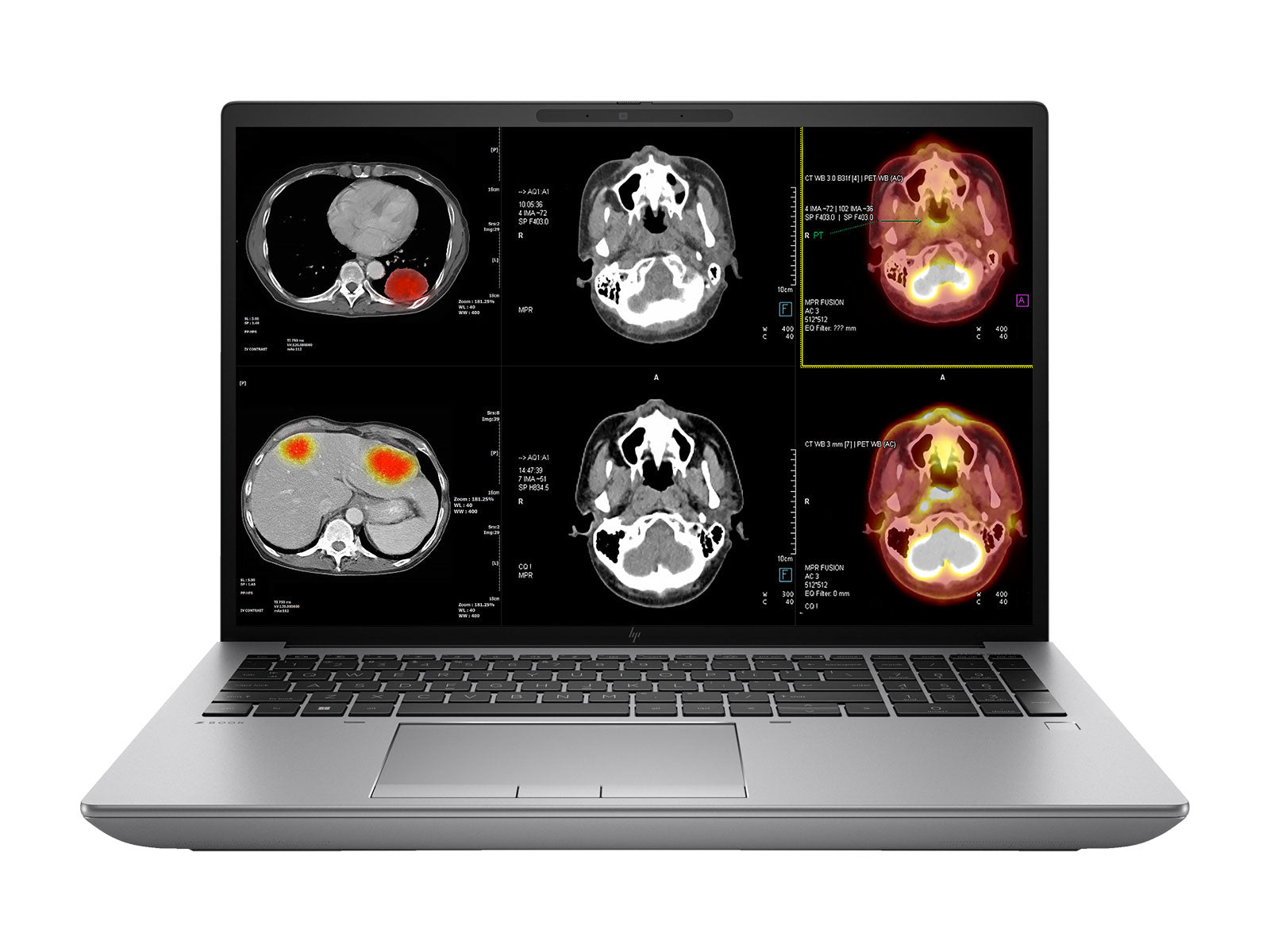 HP ZBook Fury 16 G9 Mobile Radiology Workstation | 16" WUXGA DICOM Calibrated | Core i9-12950HX @ 5.0GHz | 64GB DDR5 | 1TB NVMe SSD | NVIDIA RTX A5500 16GB | Win11 Pro