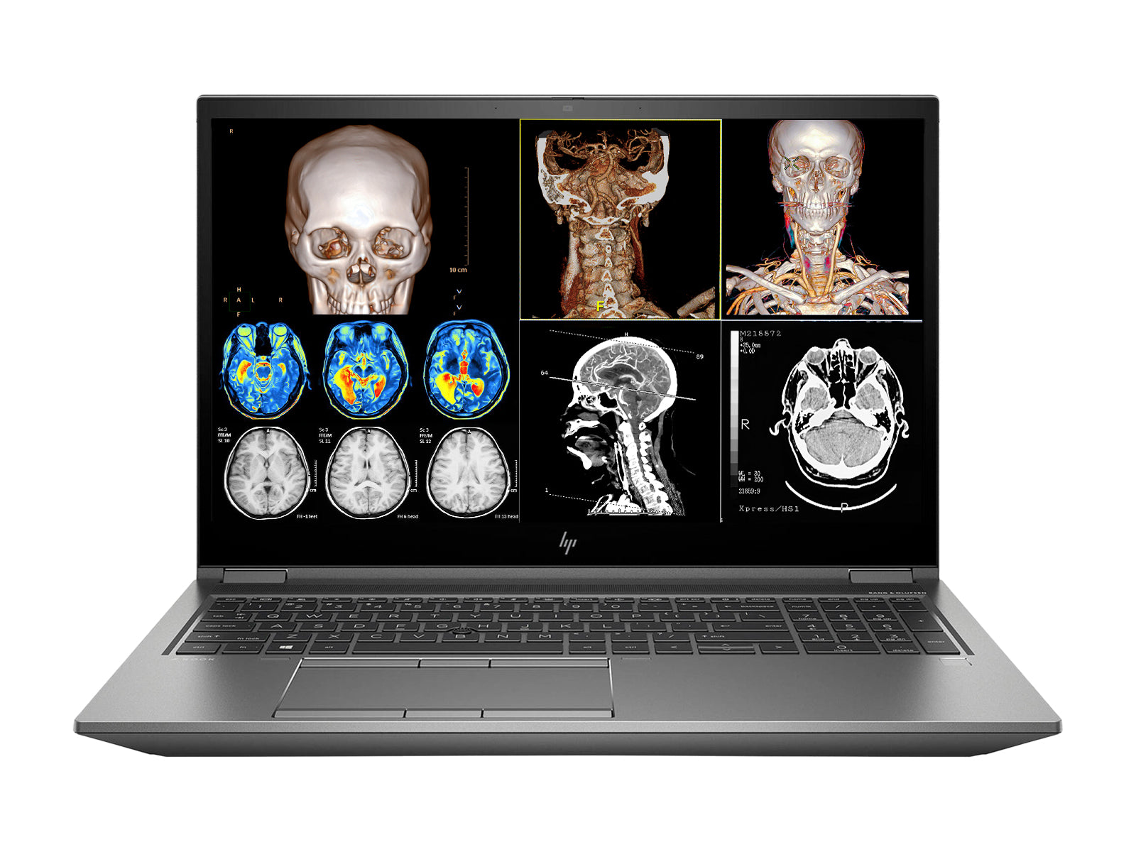 Estación de trabajo de radiología móvil HP ZBook Fury 17 G8 | 17.3" 8MP UHD DICOM calibrado | Núcleo i9-11950H a 5.0 GHz | 64 GB DDR4 | SSD NVMe de 1 TB | RTX A3000 6GB | Win10-11 Pro