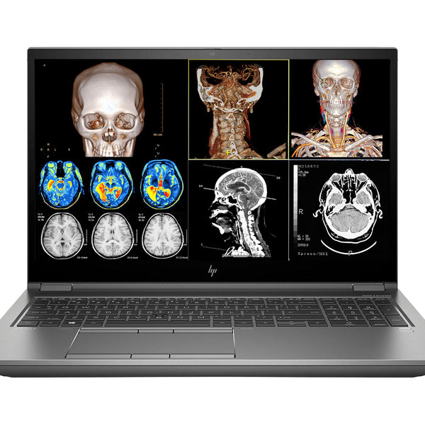 HP ZBook Fury 17 G7 Mobile Radiology Workstation | 17.3