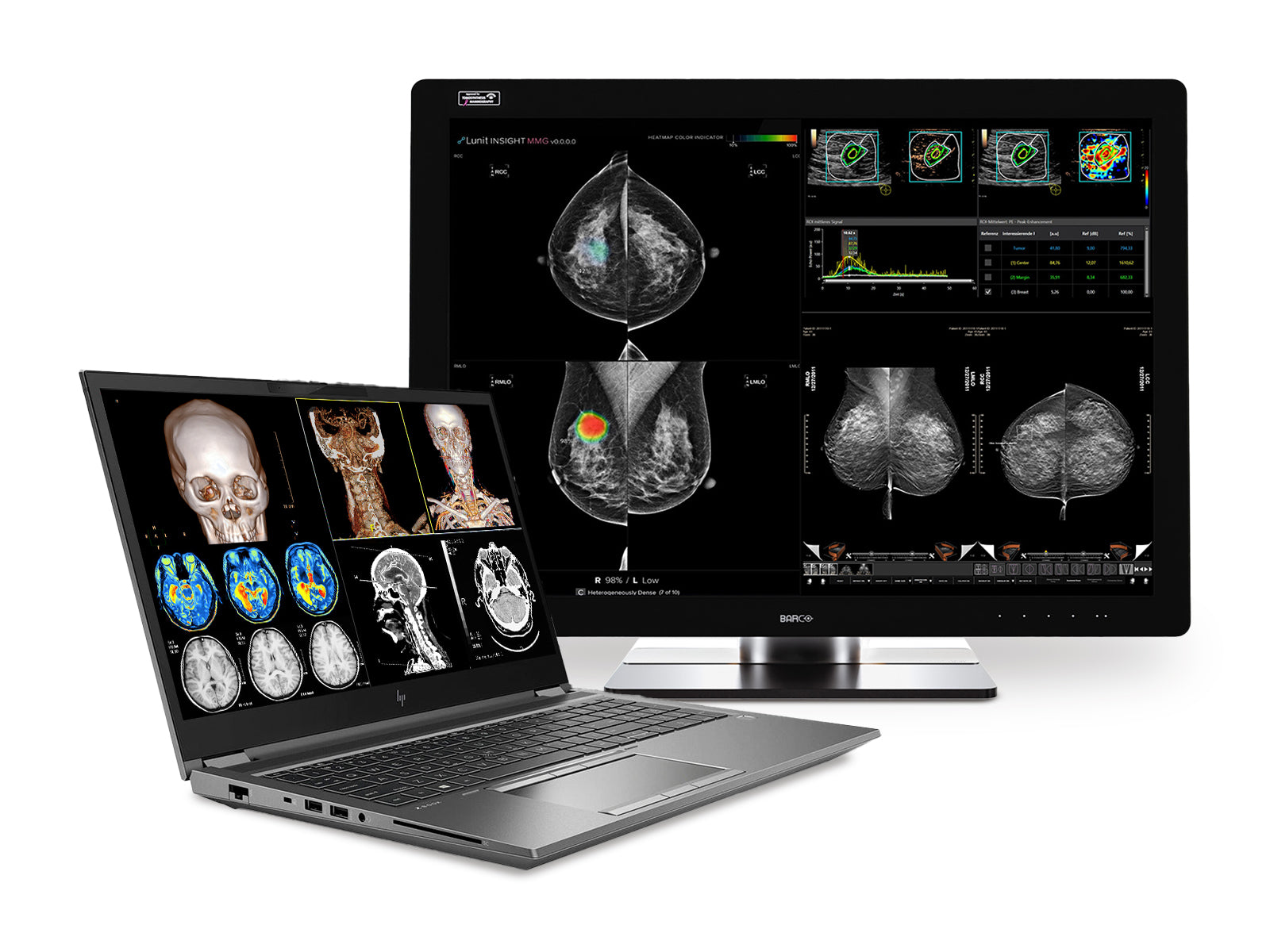 Estación de trabajo de radiología móvil HP ZBook Fury 17 G8 | 17.3" 8MP UHD DICOM calibrado | Núcleo i9-11950H a 5.0 GHz | 64 GB DDR4 | SSD NVMe de 1 TB | RTX A3000 6GB | Win10-11 Pro