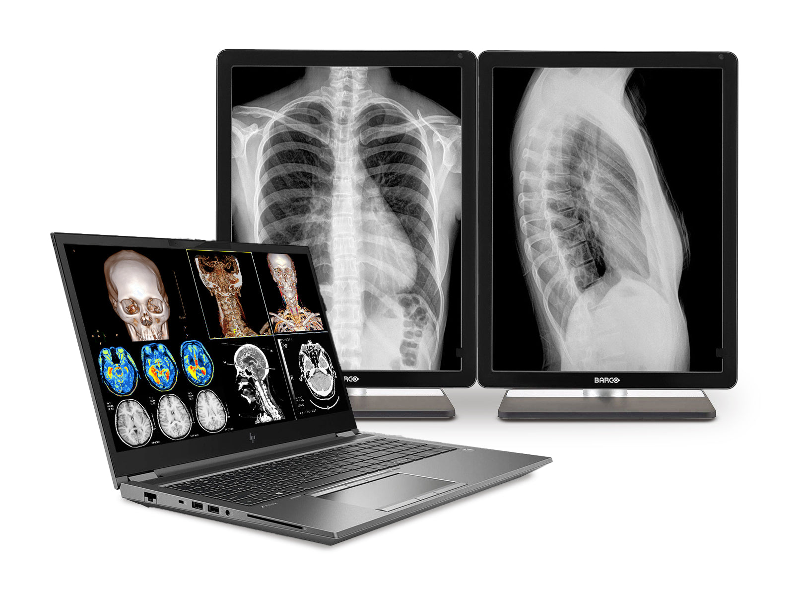 HP ZBook Fury 17 G7 Mobile Radiology Workstation | 17.3" 9MP UHD DICOM Calibrated | Core i7-10850H @ 5.10GHz | 64GB DDR4 | 1TB NVMe SSD | RTX 3000 6GB