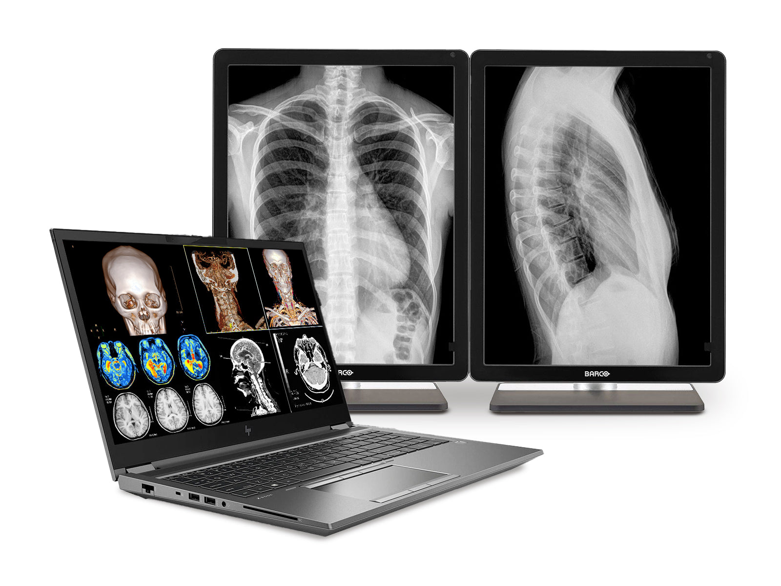 Estación de trabajo de radiología móvil HP ZBook Fury 17 G8 | 17.3" 8MP UHD DICOM calibrado | Núcleo i9-11950H a 5.0 GHz | 64 GB DDR4 | SSD NVMe de 1 TB | RTX A3000 6GB | Win10-11 Pro