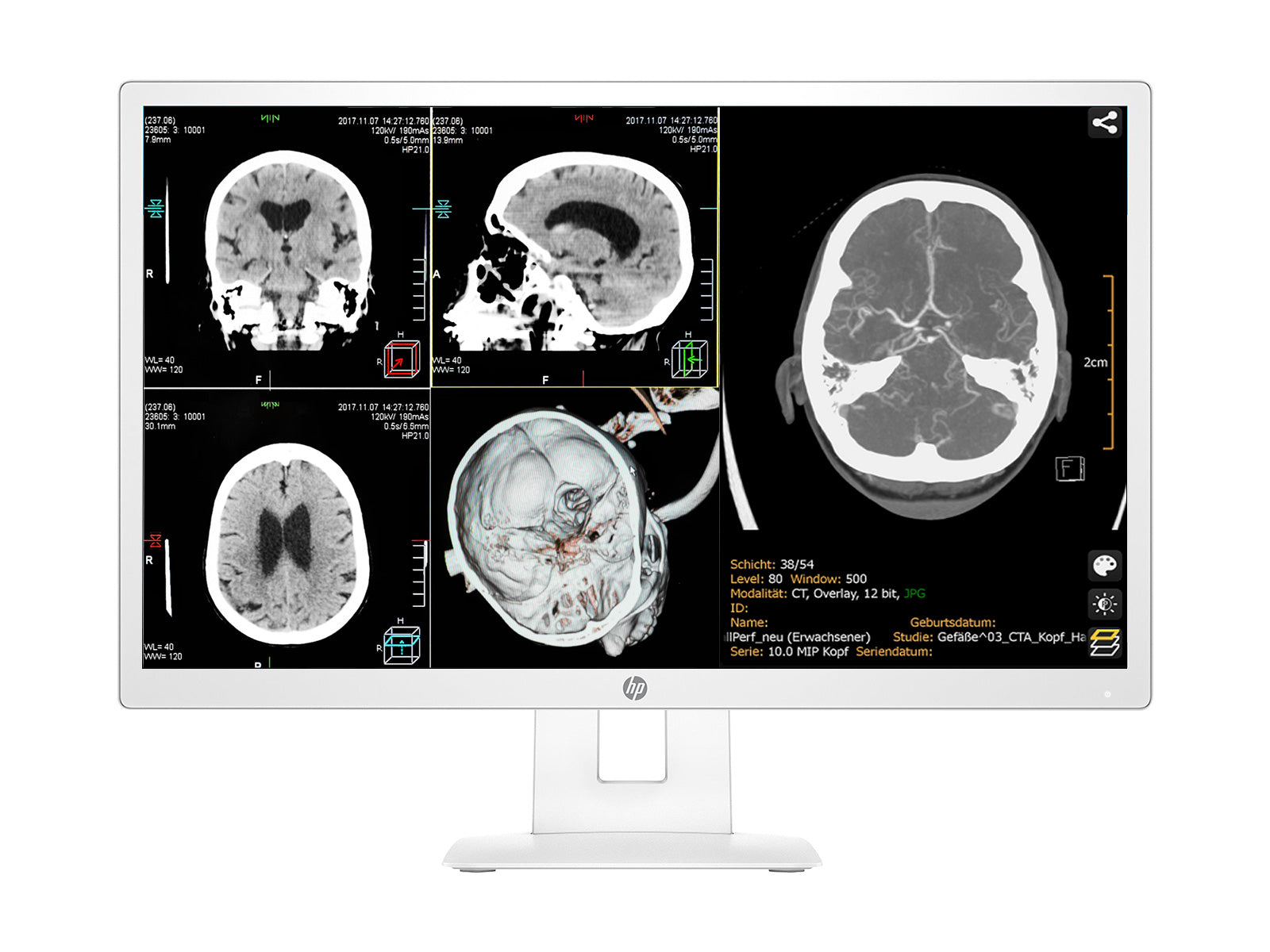 Monitor de pantalla de revisión clínica en color QHD HP Healthcare Edition HC271 de 27" (3ME70A8#ABA)
