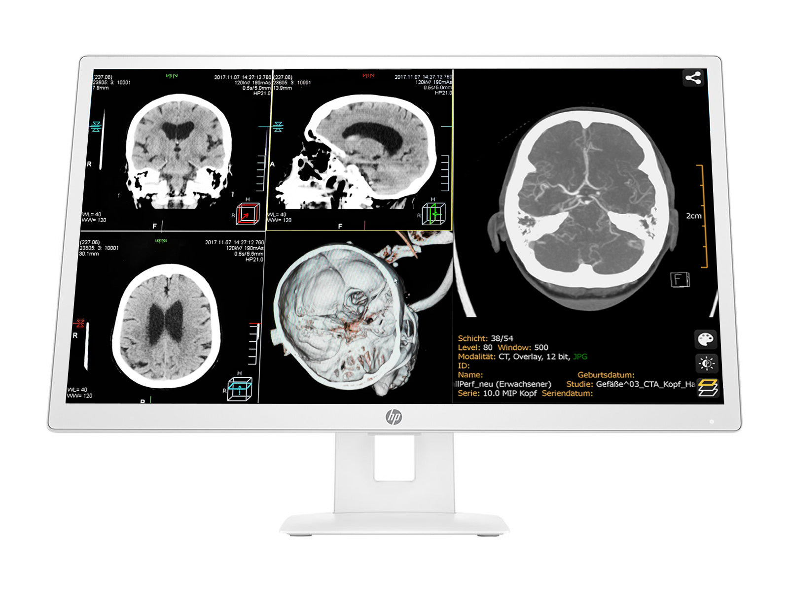 HP 27" 3MP DICOM Clinical Review Monitor mit medizinischem Display