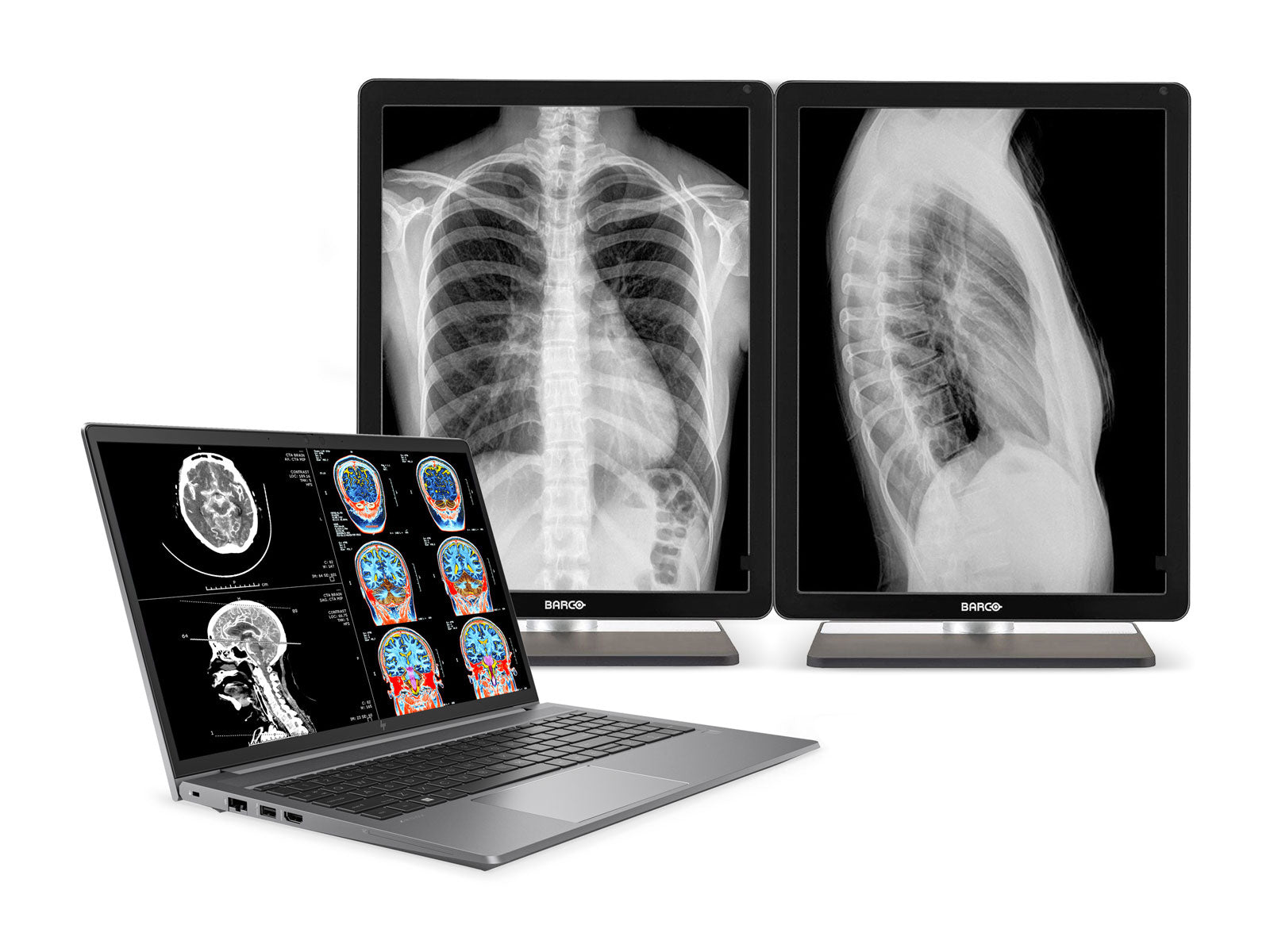 HP ZBook Power 15 G9 Mobile Radiology Workstation | 15.6" UHD 8MP+ DICOM Calibrated | Core i7-12700H @ 4.70GHz | 32GB DDR5 | 512GB NVMe SSD | NVIDIA RTX A2000 8GB | Win11 Pro Monitors.com 
