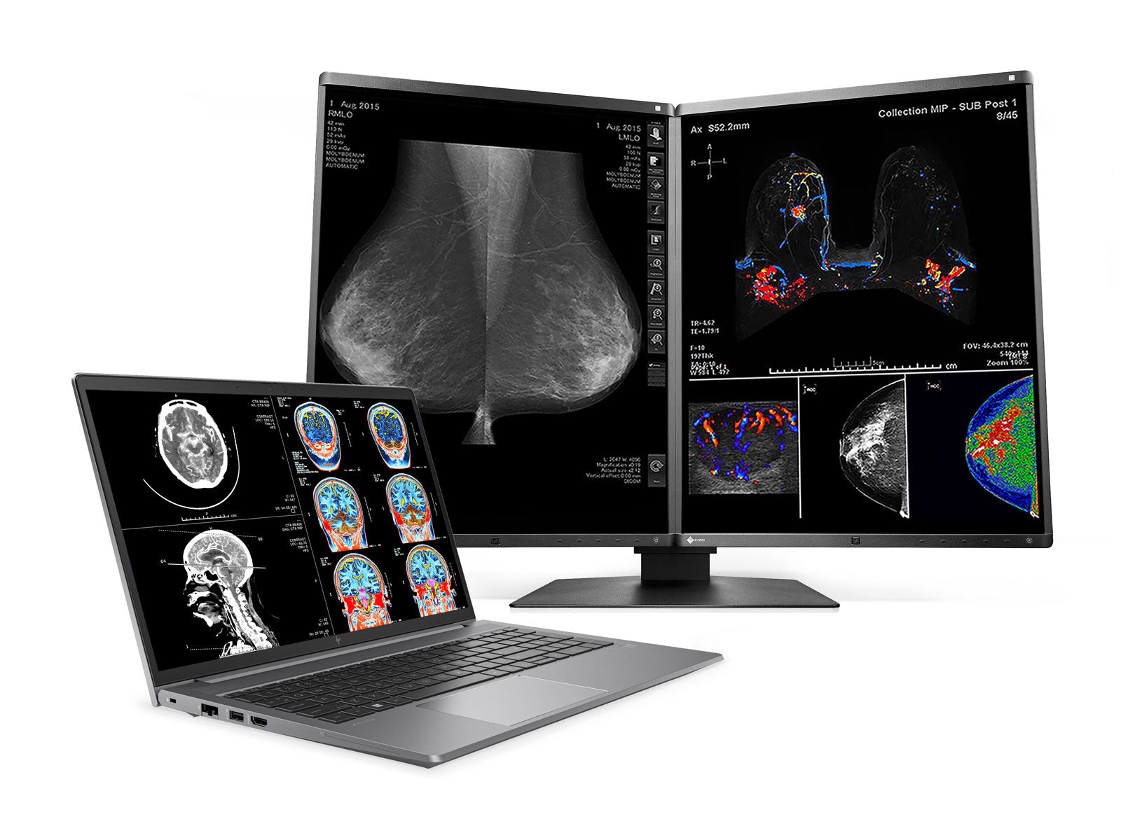 HP ZBook Power 15 G9 Mobile Radiology Workstation | 15.6" UHD 8MP+ DICOM Calibrated | Core i7-12700H @ 4.70GHz | 32GB DDR5 | 512GB NVMe SSD | NVIDIA RTX A2000 8GB | Win11 Pro Monitors.com 