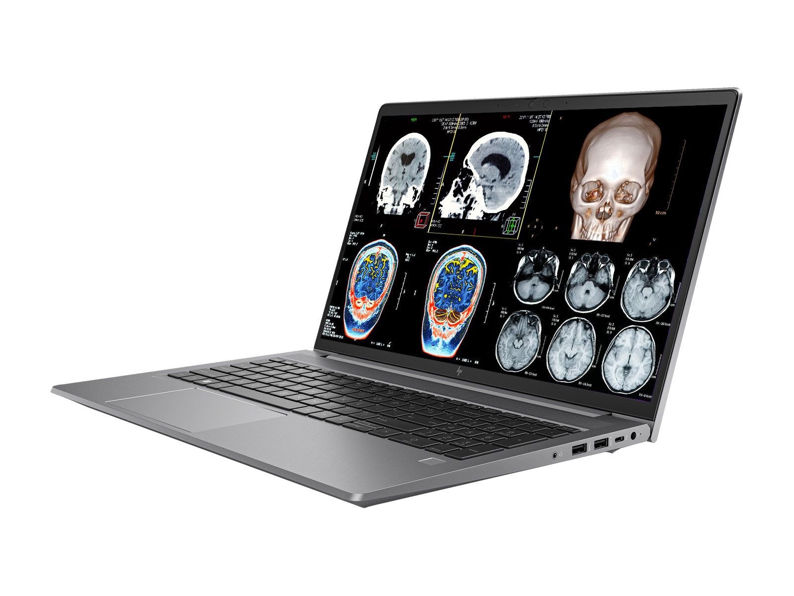 HP ZBook Power G11 Mobile Workstation | 15.6" FHD DICOM Calibrated | Intel Core Ultra 7 165H @ 4.9 GHz | 12-Core | 32GB DDR5 | 512GB NVMe SSD | NVIDIA RTX 1000 Ada 6GB